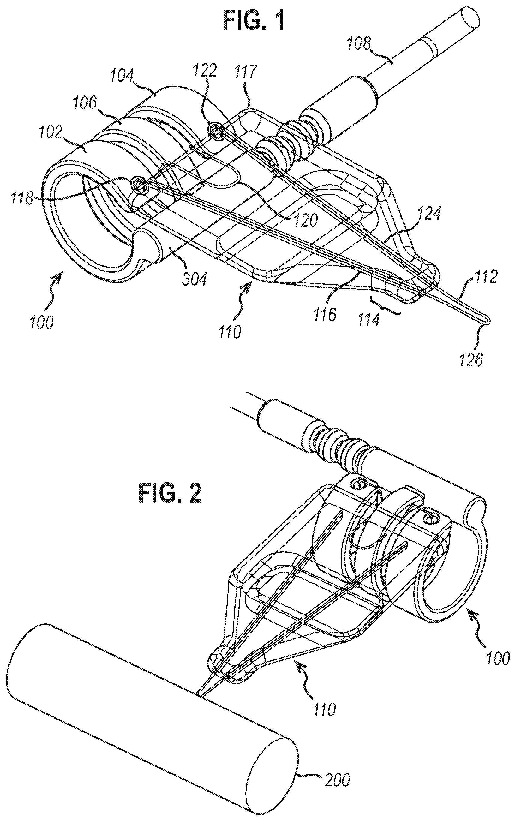 Patent US12472350 Figure 1 – Systems and methods for laparoscopic delivery and deployment of a neural interface