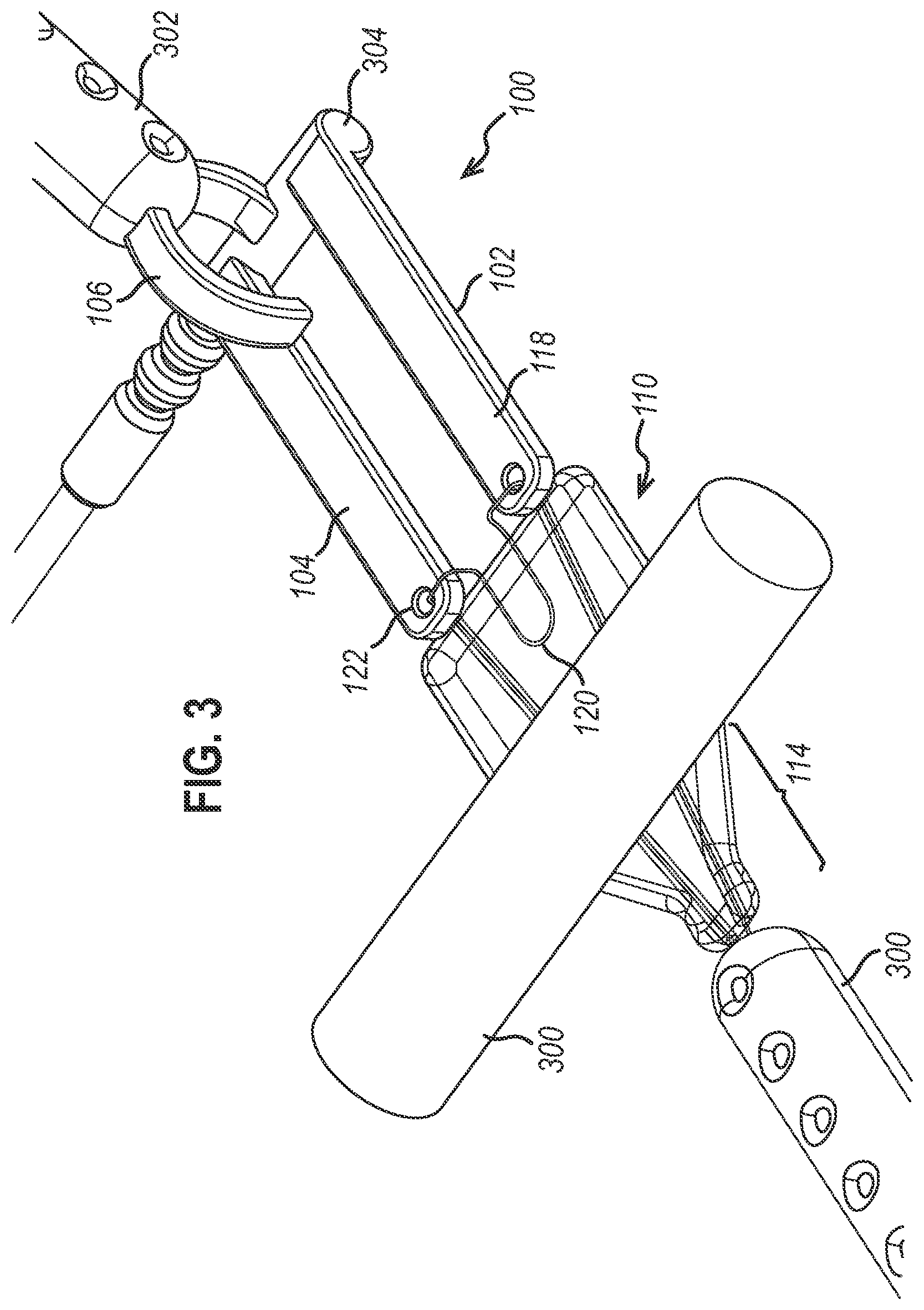 Patent US12472350 Figure 2 – Systems and methods for laparoscopic delivery and deployment of a neural interface