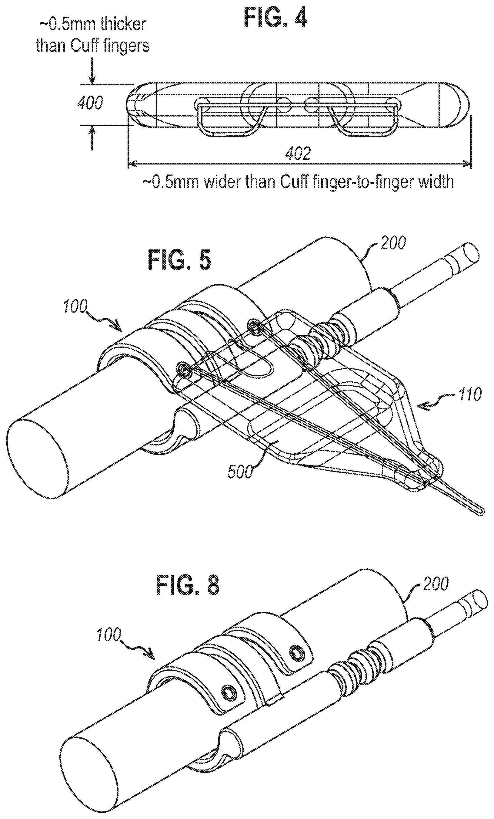 Patent US12472350 Figure 3 – Systems and methods for laparoscopic delivery and deployment of a neural interface