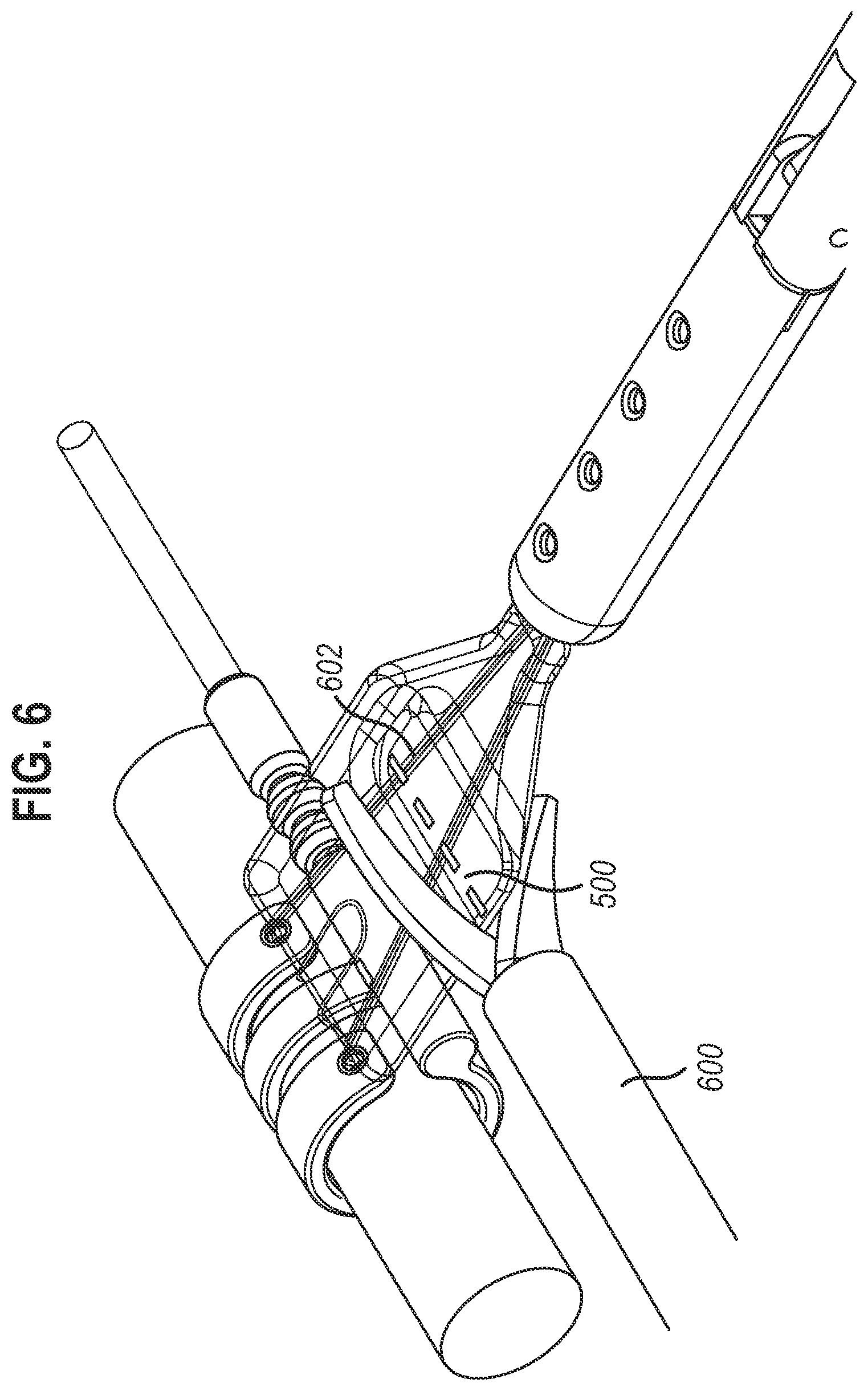 Patent US12472350 Figure 4 – Systems and methods for laparoscopic delivery and deployment of a neural interface