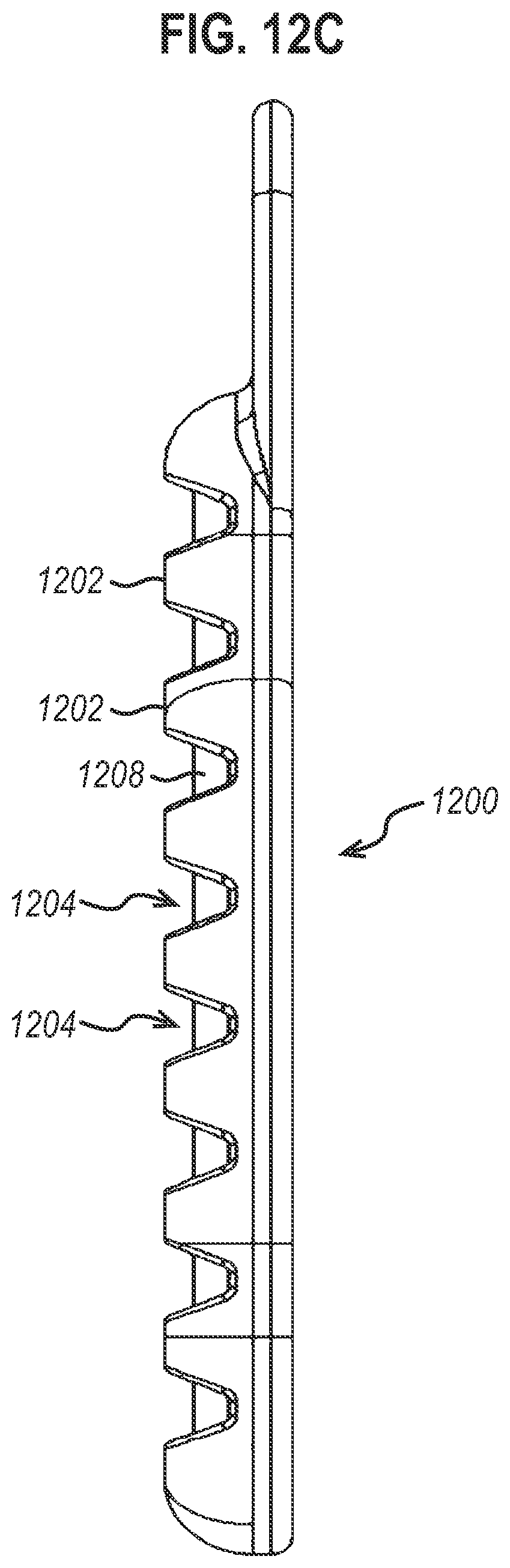 Patent US12472350 Figure 10 – Systems and methods for laparoscopic delivery and deployment of a neural interface
