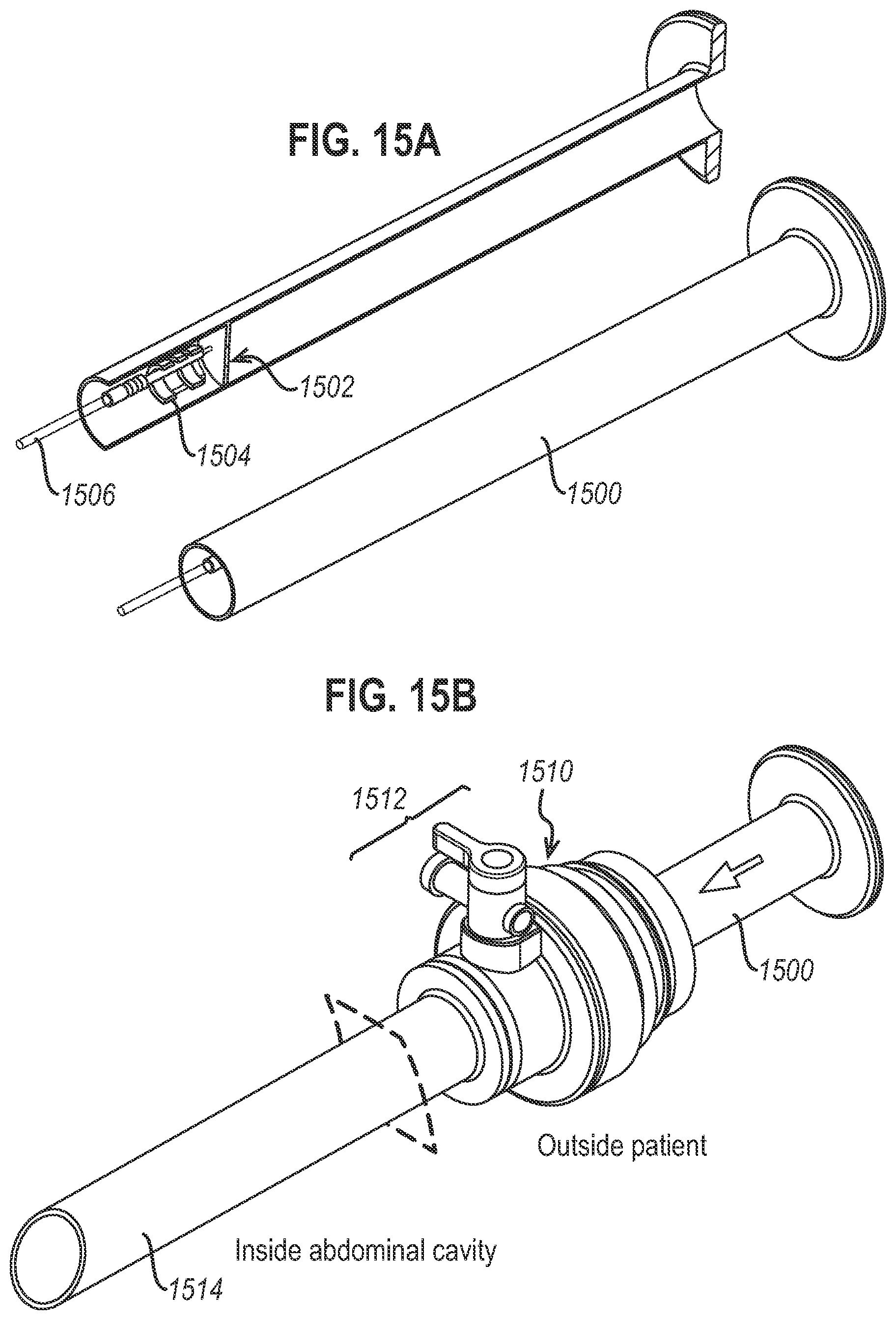 Patent US12472350 Figure 17 – Systems and methods for laparoscopic delivery and deployment of a neural interface