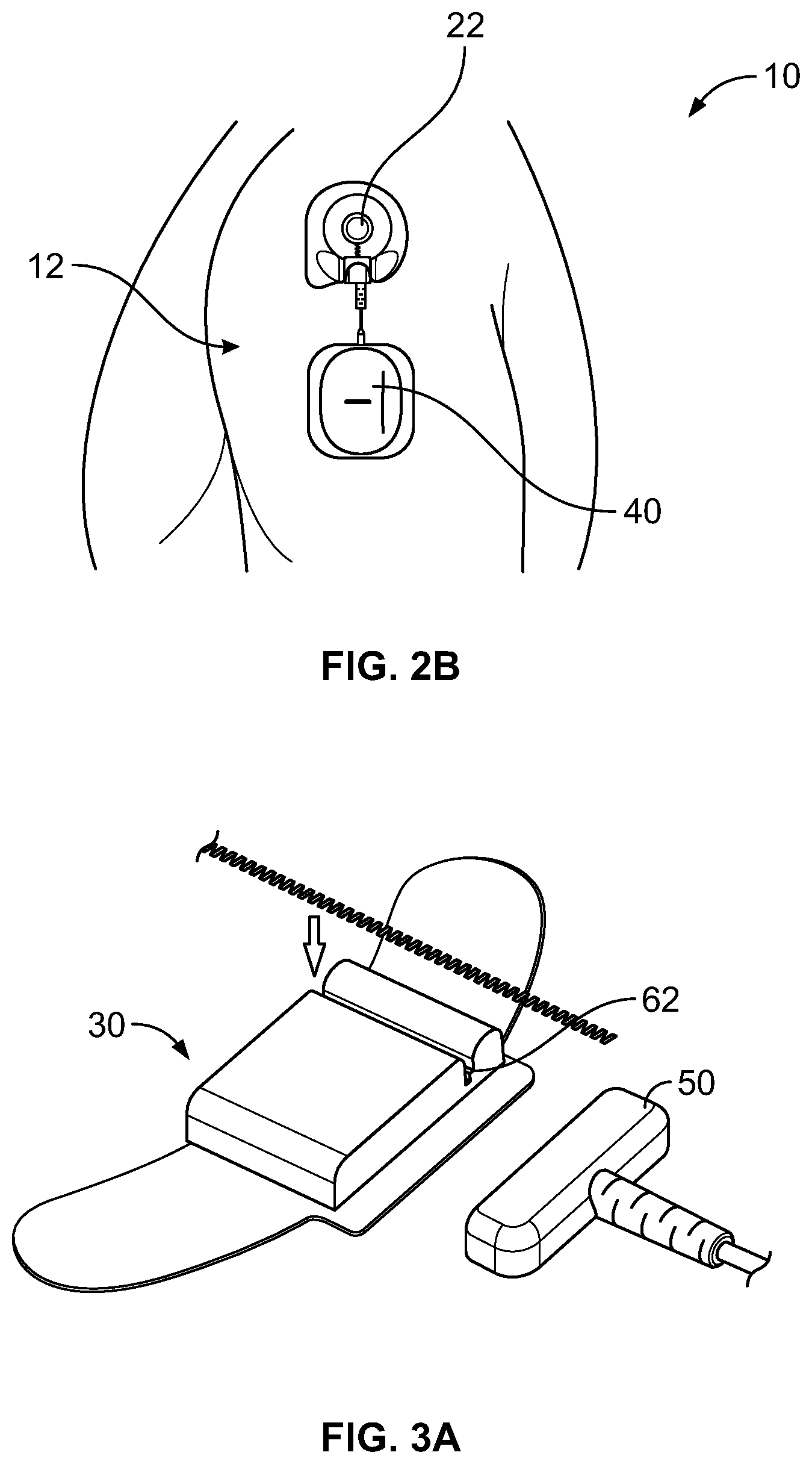 Patent US12472354 Figure 2 – Electrical stimulator for peripheral stimulation