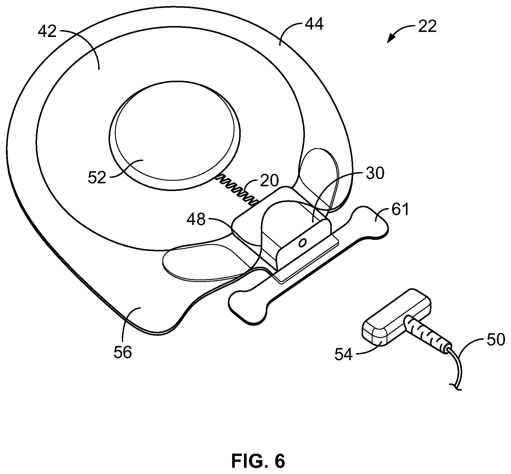 Patent US12472354 Figure 6 – Electrical stimulator for peripheral stimulation