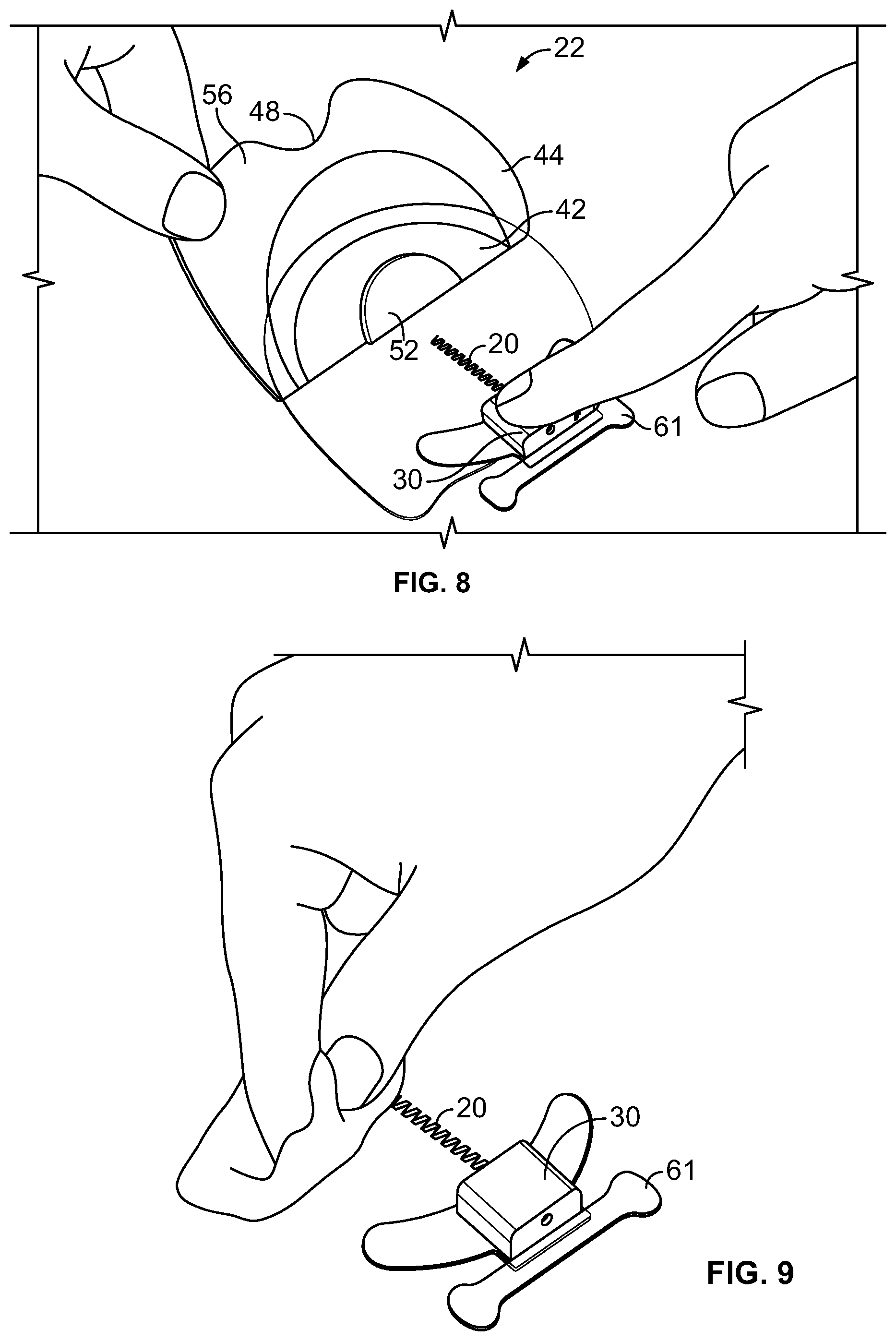 Patent US12472354 Figure 8 – Electrical stimulator for peripheral stimulation