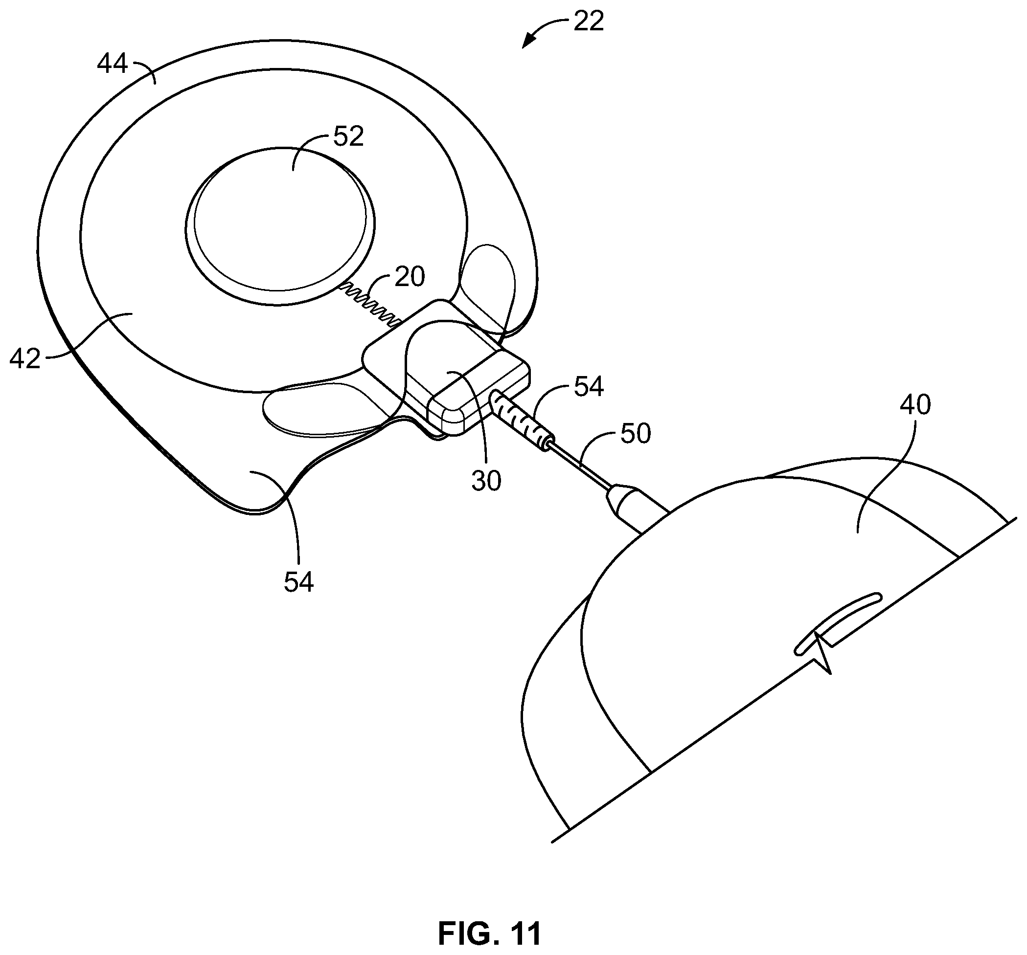 Patent US12472354 Figure 10 – Electrical stimulator for peripheral stimulation