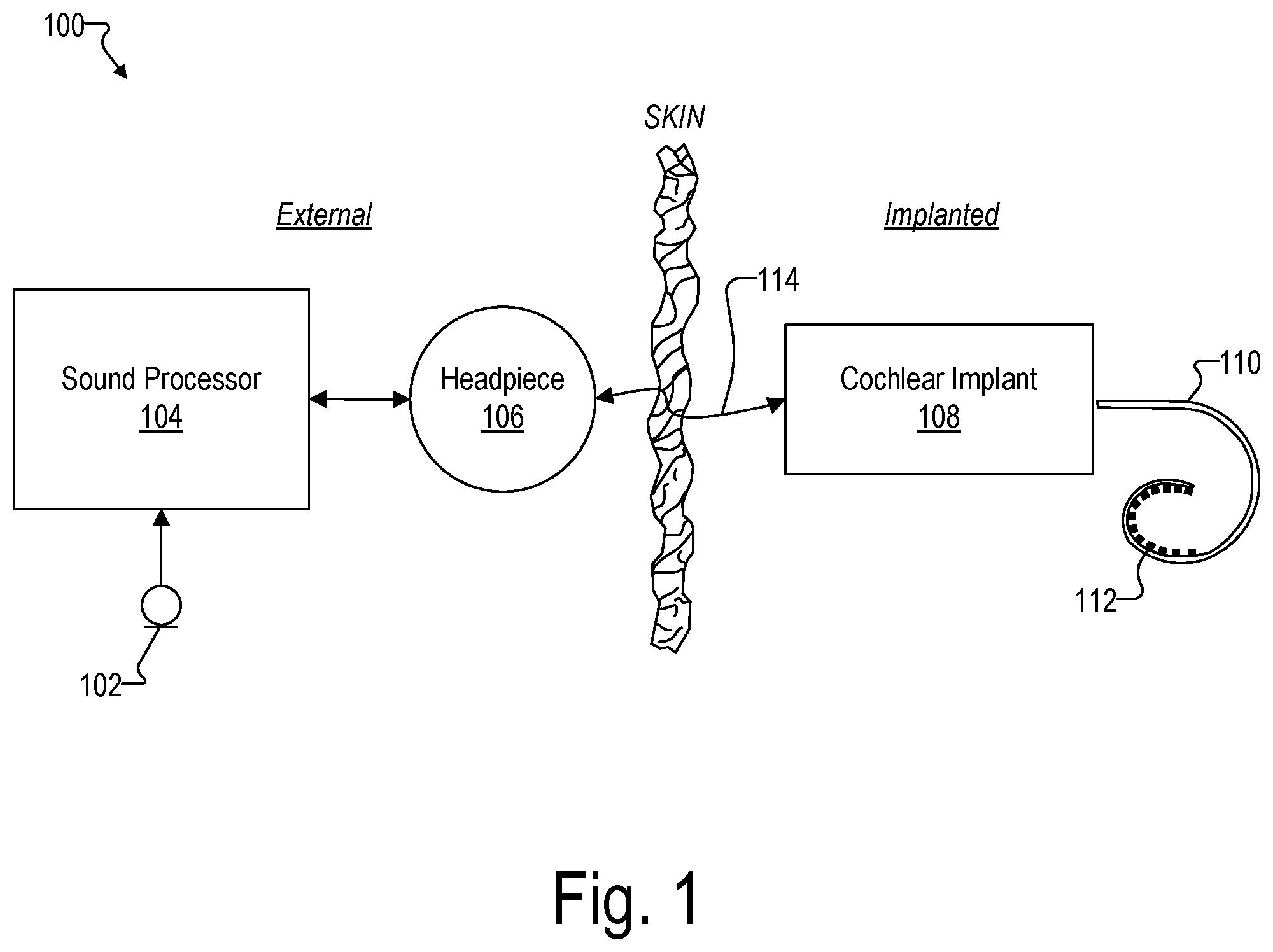 Patent US12472356 Figure 1 – Systems for optimizing evoked response signal generation during an electrode lead insertion procedure