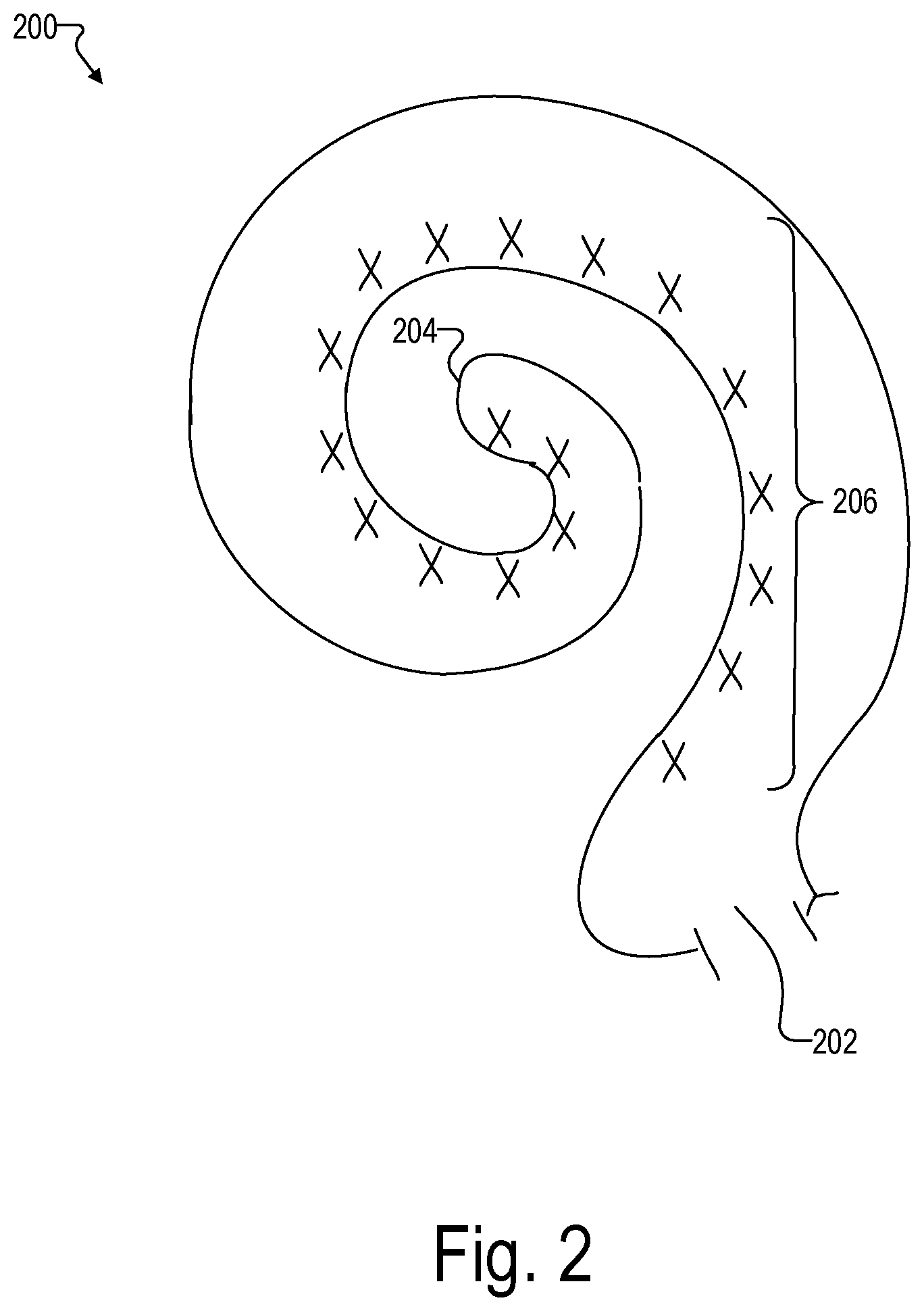 Patent US12472356 Figure 2 – Systems for optimizing evoked response signal generation during an electrode lead insertion procedure