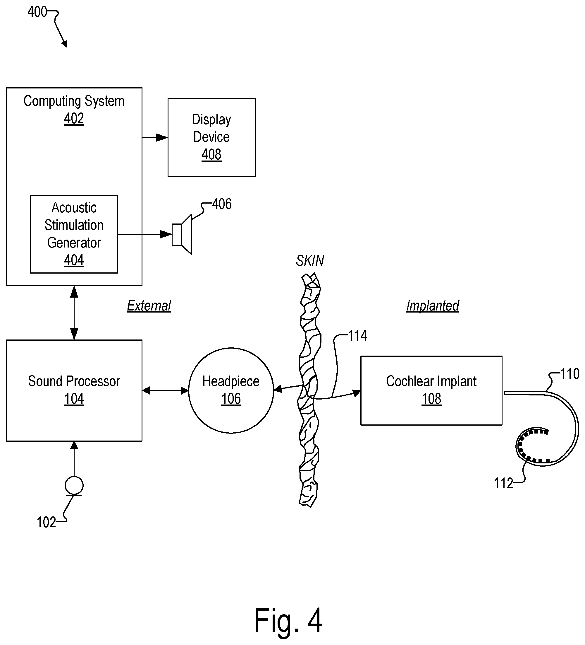 Patent US12472356 Figure 4 – Systems for optimizing evoked response signal generation during an electrode lead insertion procedure