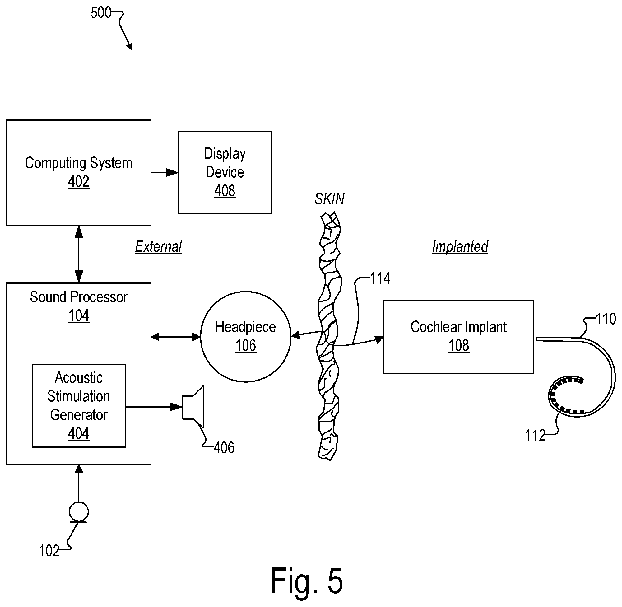 Patent US12472356 Figure 5 – Systems for optimizing evoked response signal generation during an electrode lead insertion procedure