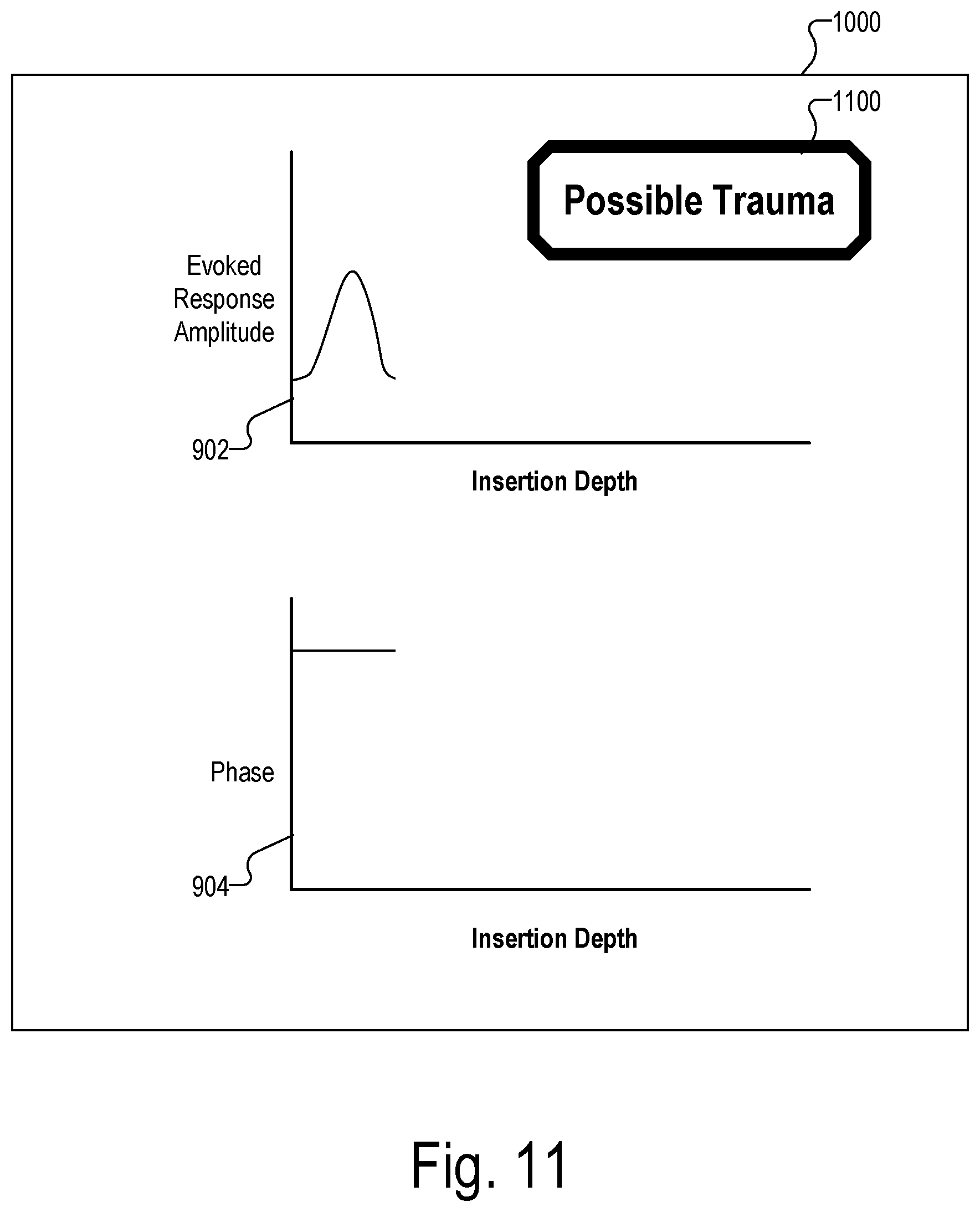 Patent US12472356 Figure 12 – Systems for optimizing evoked response signal generation during an electrode lead insertion procedure