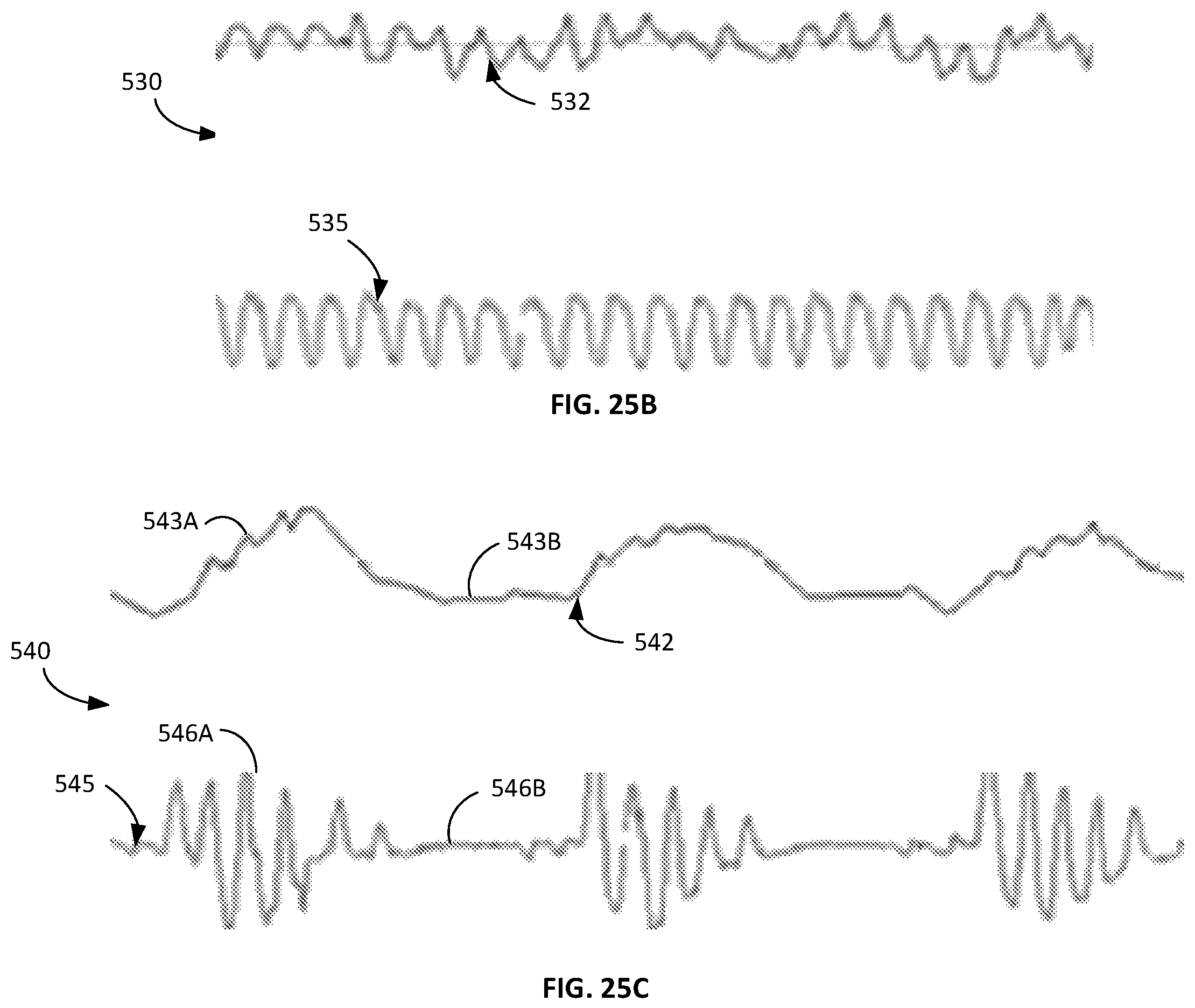 Patent US12472357 Figure 9 – Multiple type sleep apnea