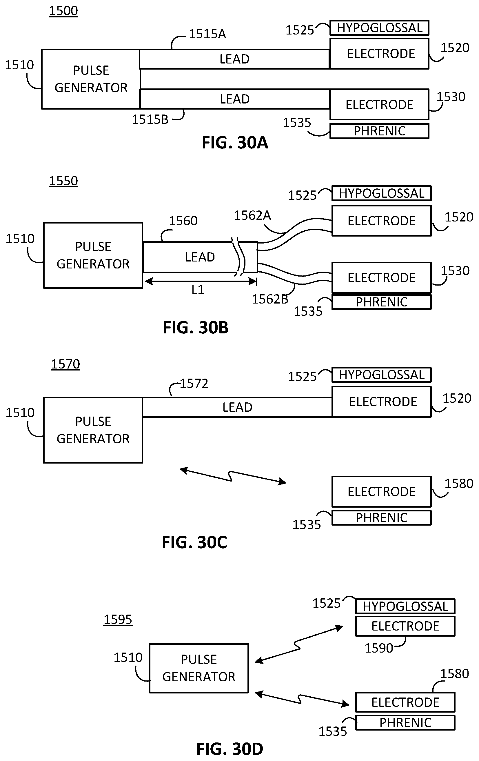 Patent US12472357 Figure 12 – Multiple type sleep apnea