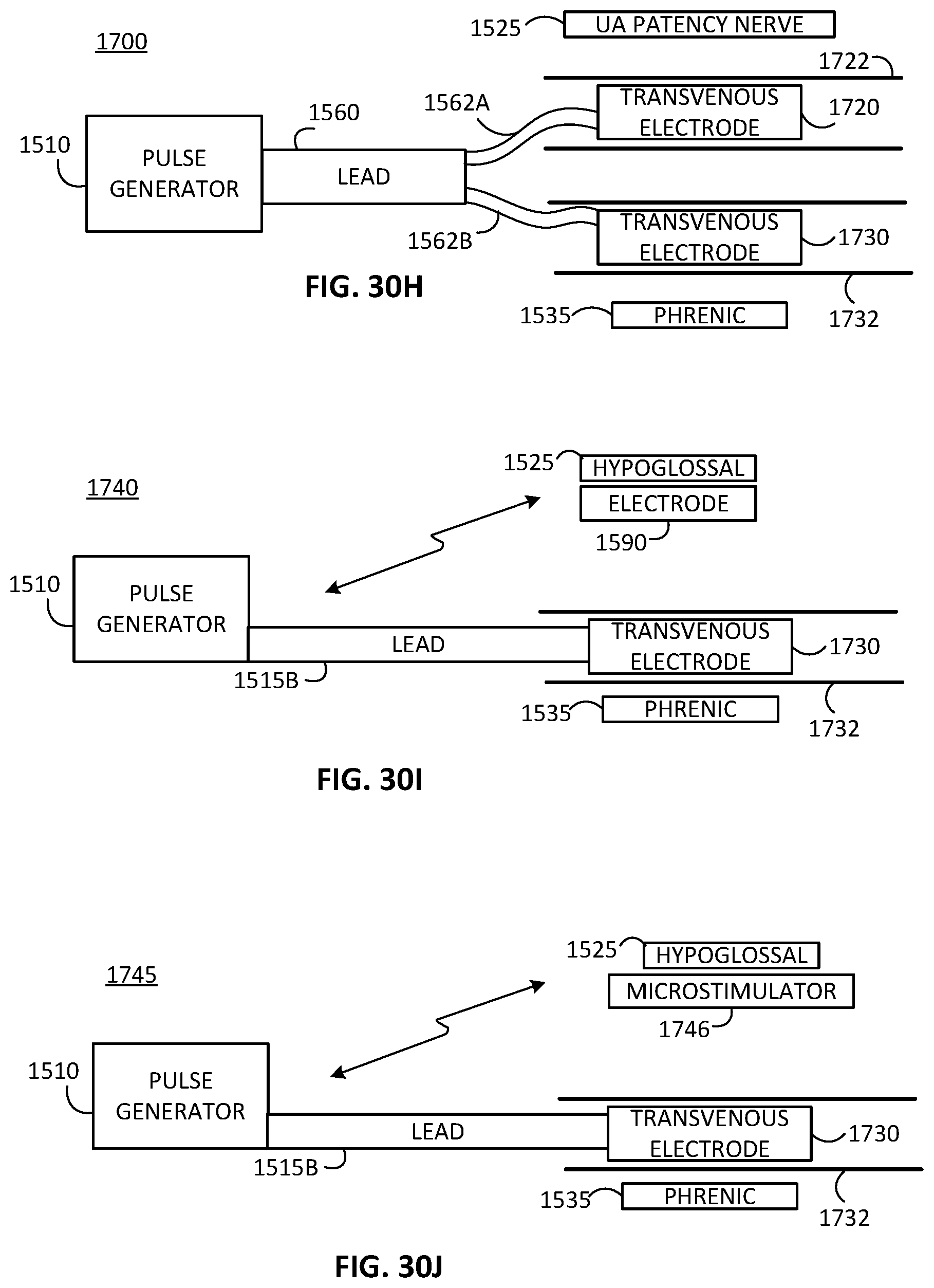 Patent US12472357 Figure 14 – Multiple type sleep apnea