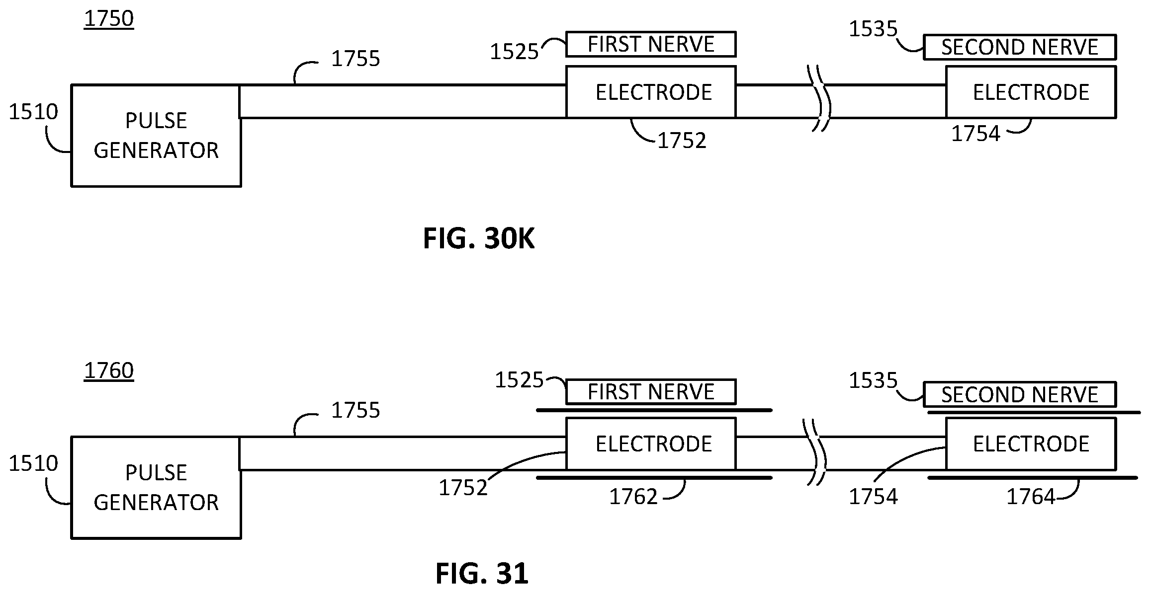 Patent US12472357 Figure 15 – Multiple type sleep apnea