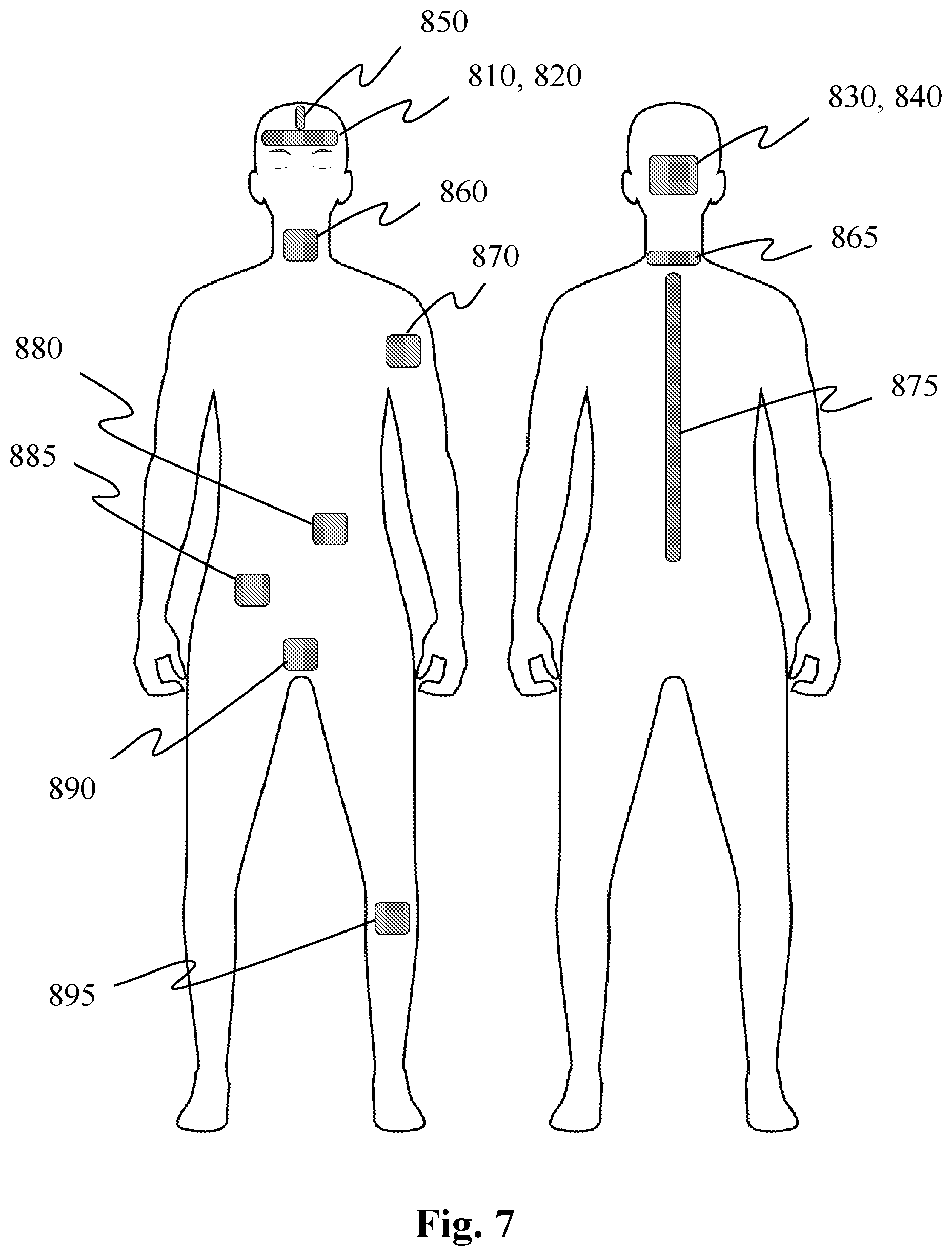 Patent US12472358 Figure 6 – Method of operating an electrical stimulation device with two or more stimulation energy supplies, and a stimulating device