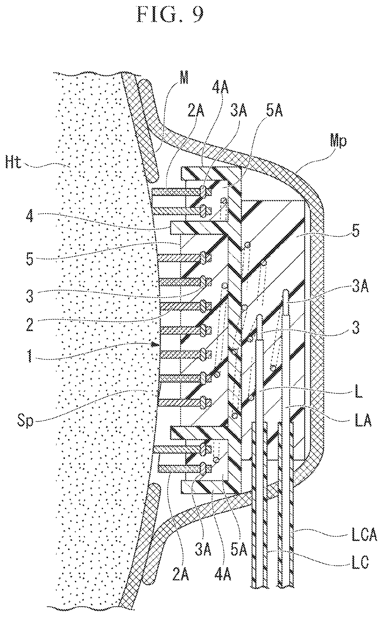 Patent US12472359 Figure 8 – Biological electrode and cardiac pacemaker