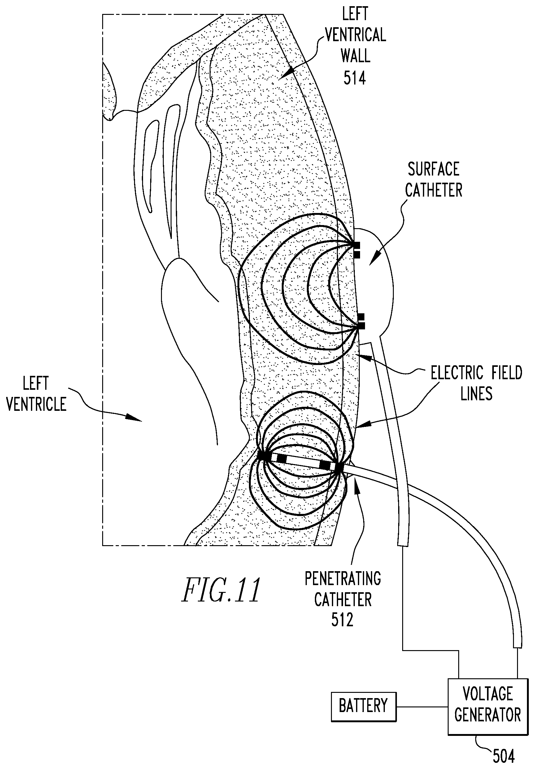 Patent US12472360 Figure 6 – Method and apparatus for determining cardiac performance in a patient