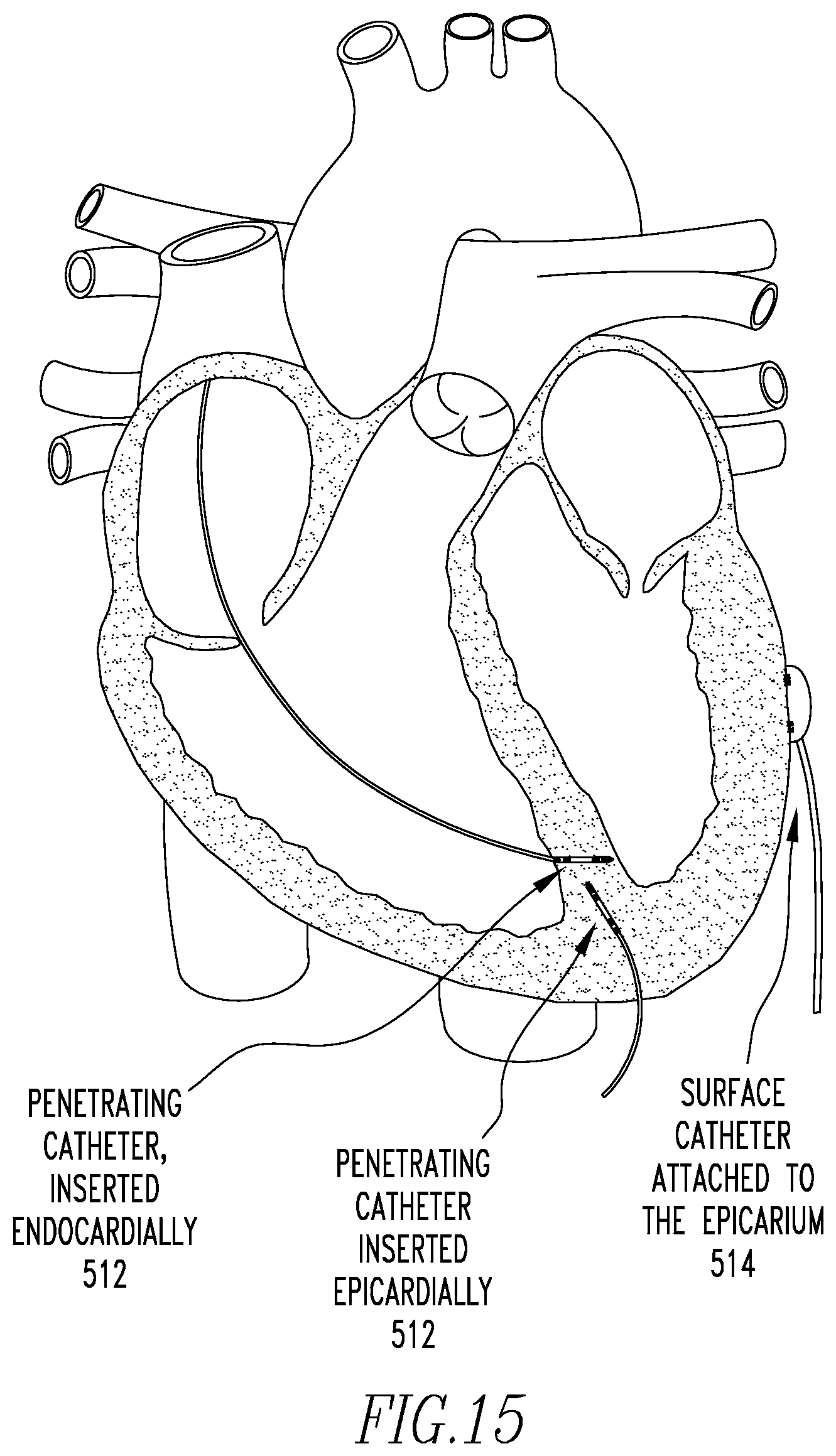 Patent US12472360 Figure 8 – Method and apparatus for determining cardiac performance in a patient