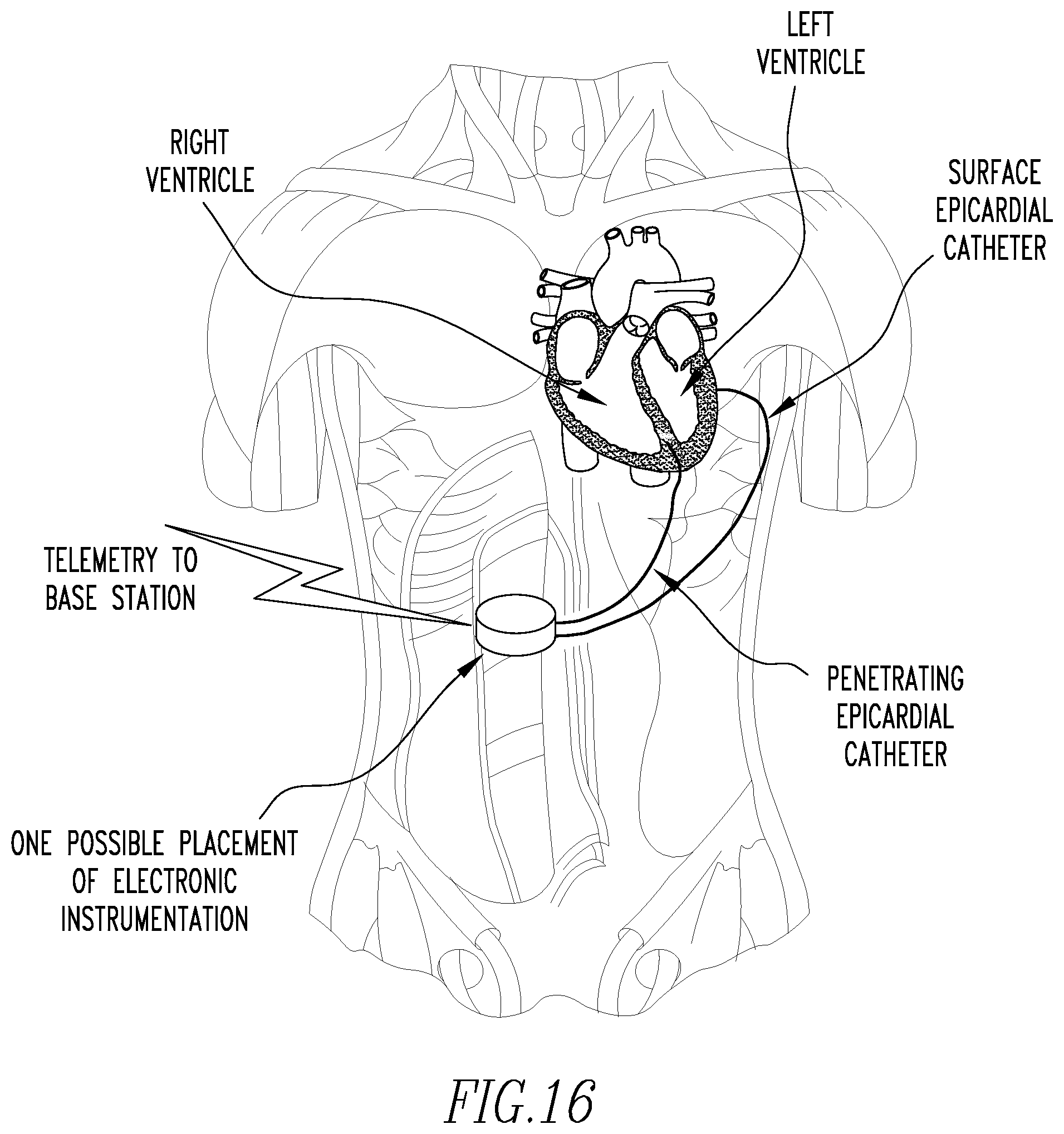 Patent US12472360 Figure 9 – Method and apparatus for determining cardiac performance in a patient