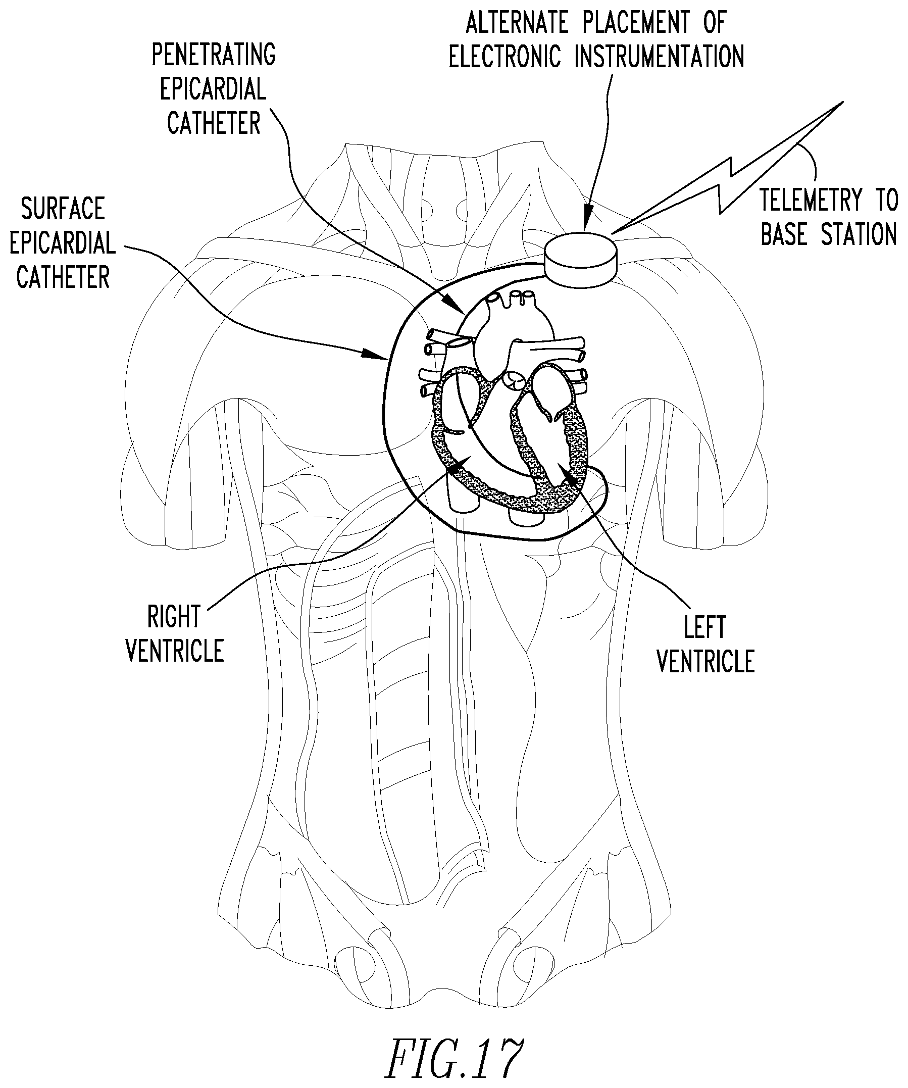 Patent US12472360 Figure 10 – Method and apparatus for determining cardiac performance in a patient