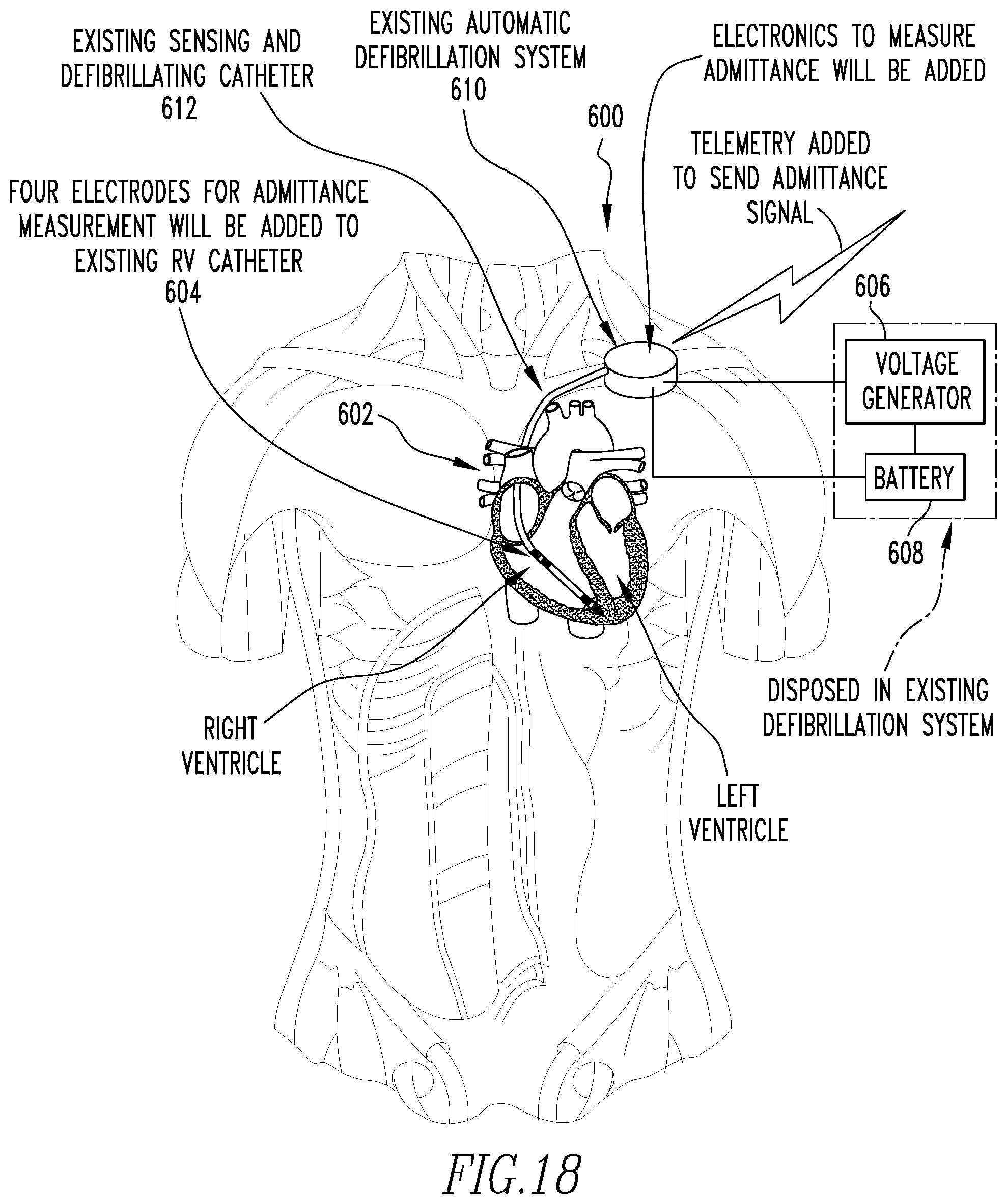 Patent US12472360 Figure 11 – Method and apparatus for determining cardiac performance in a patient