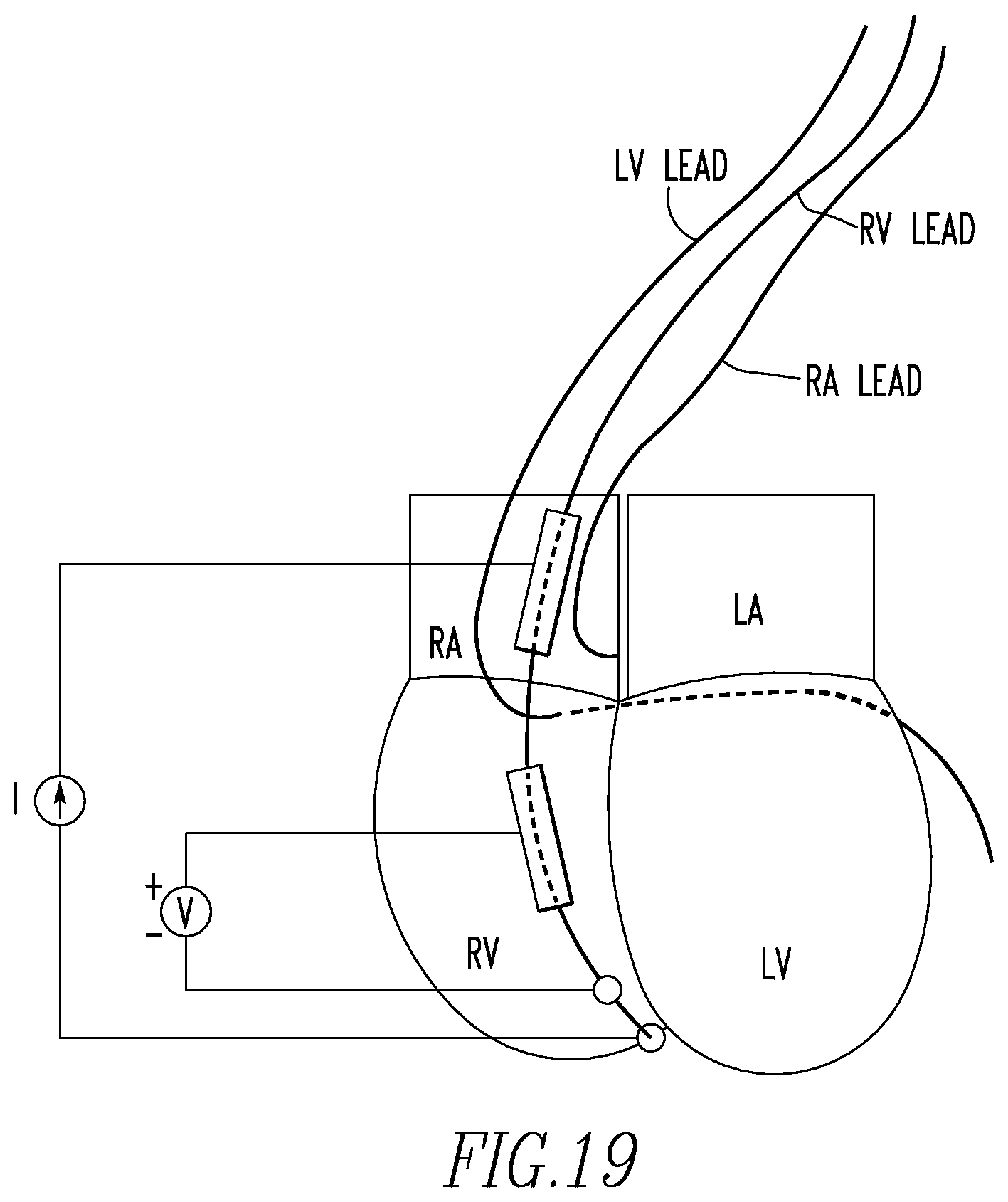 Patent US12472360 Figure 12 – Method and apparatus for determining cardiac performance in a patient