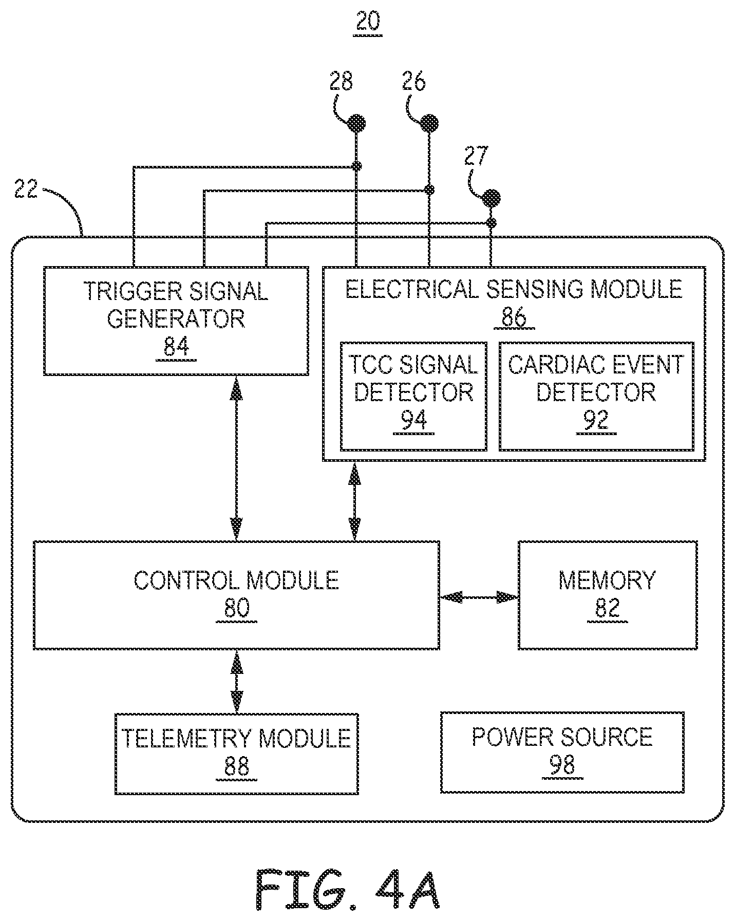 Patent US12472361 Figure 4 – Atrial synchronized ventricular pacing system