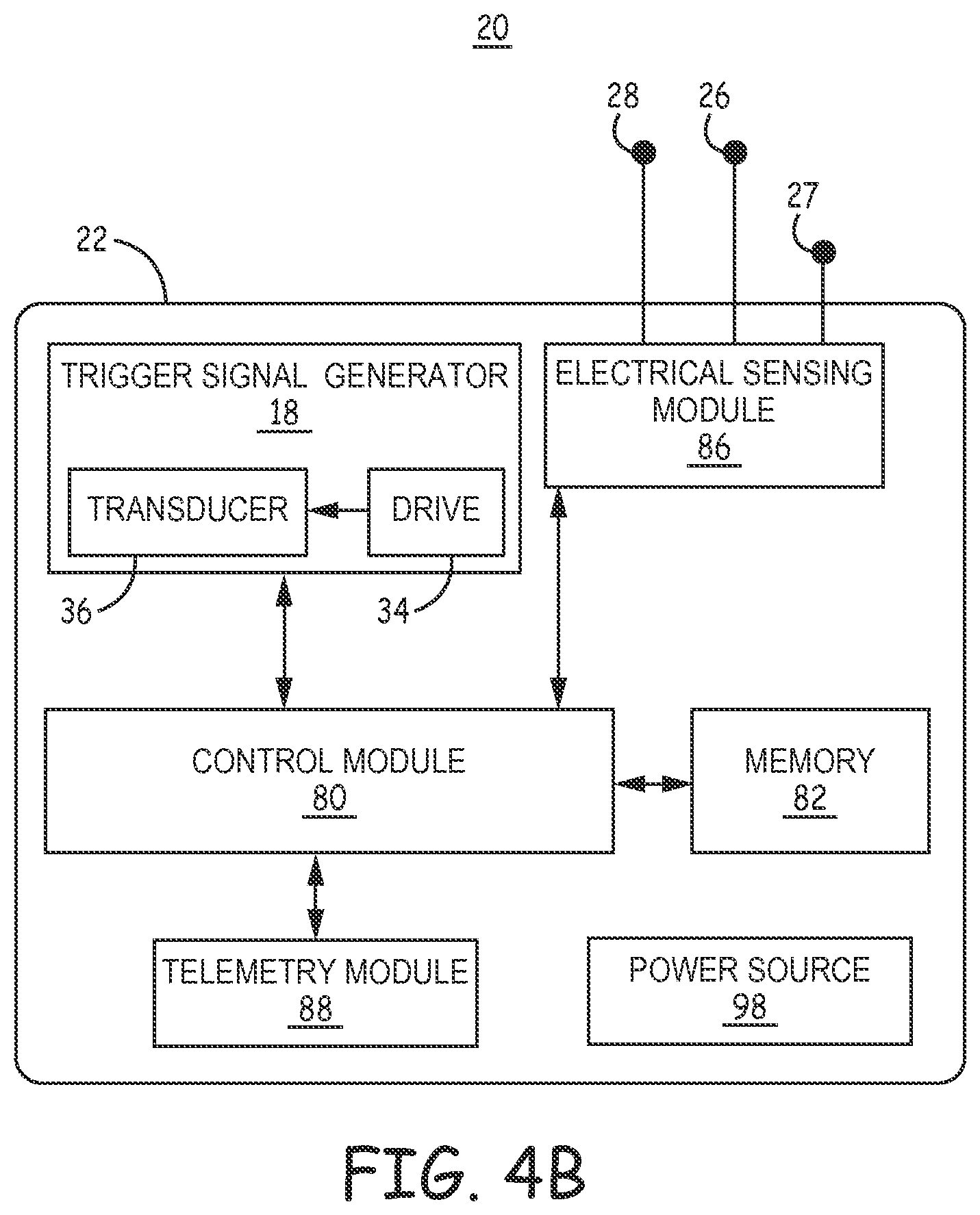 Patent US12472361 Figure 5 – Atrial synchronized ventricular pacing system