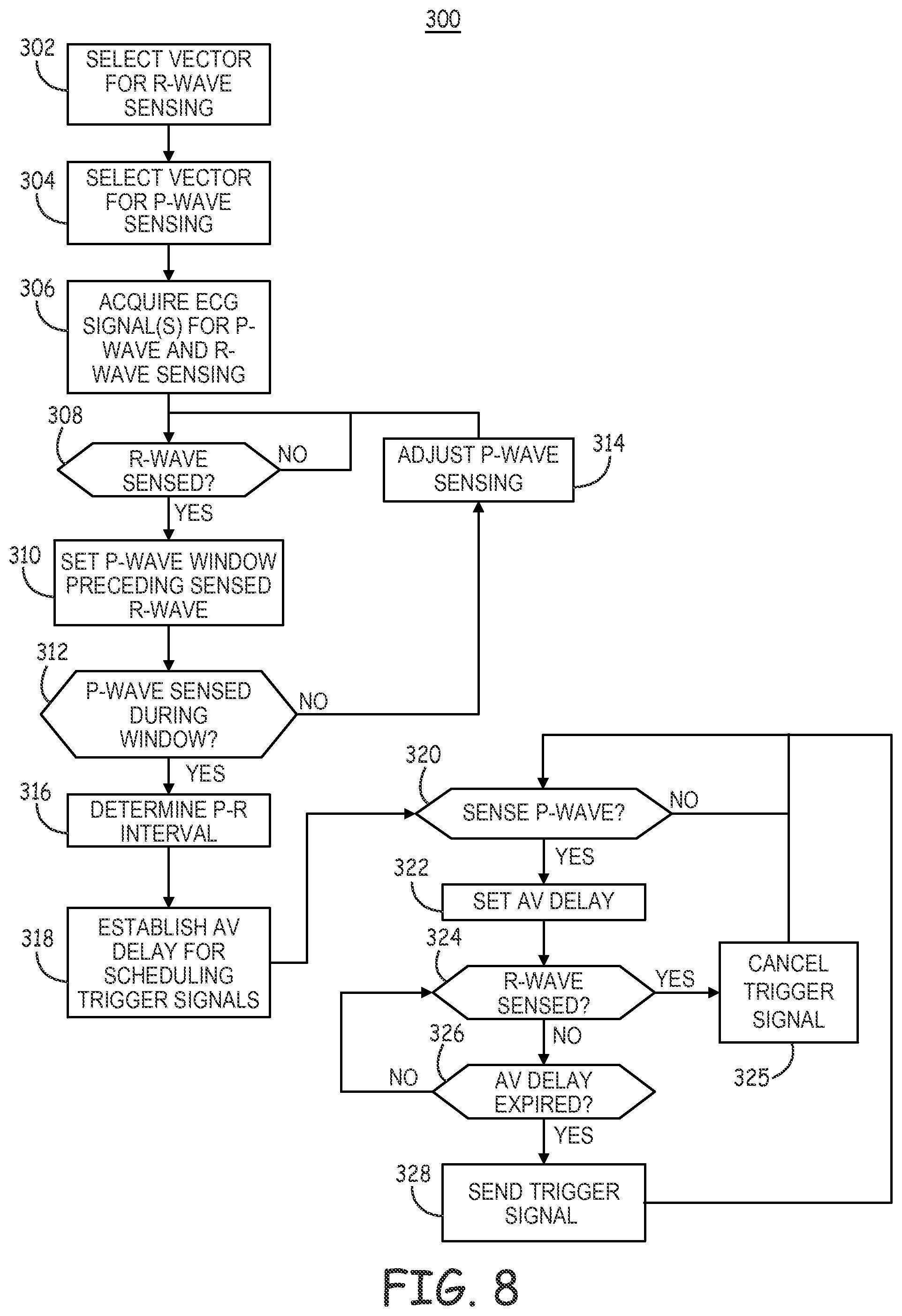 Patent US12472361 Figure 10 – Atrial synchronized ventricular pacing system