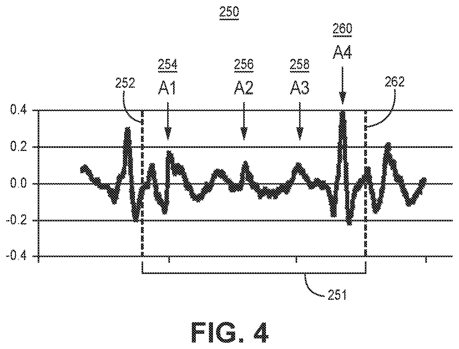 Patent US12472363 Figure 4 – Pacing mode switching in a ventricular pacemaker