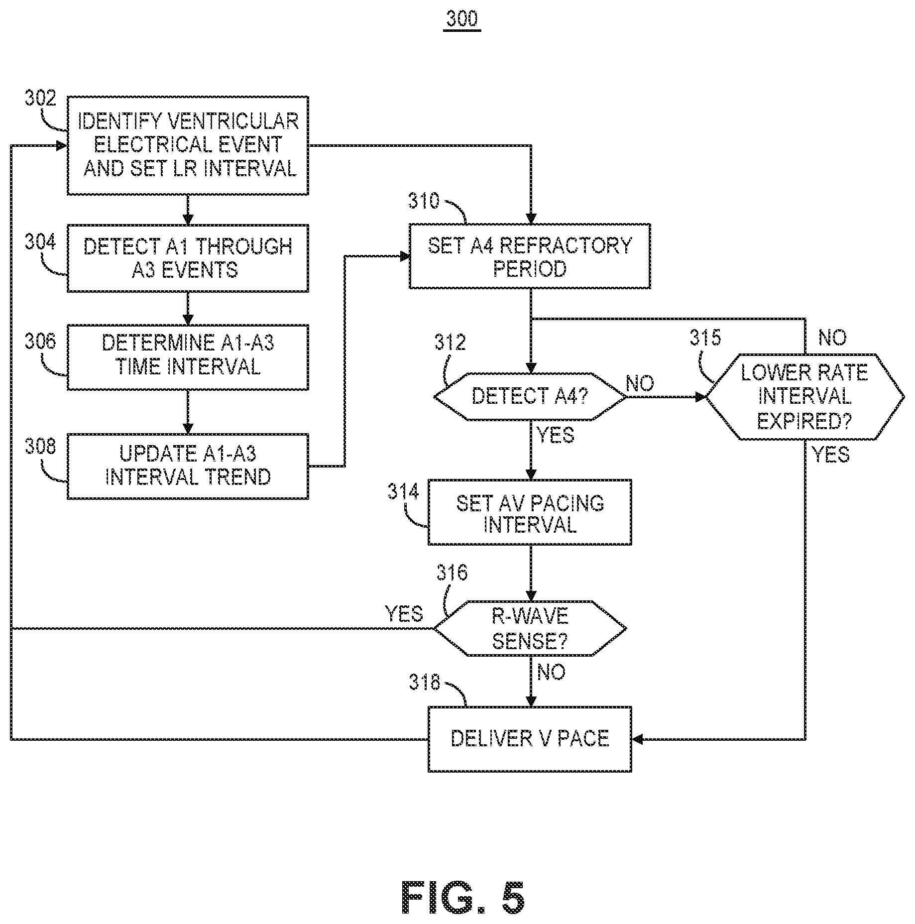 Patent US12472363 Figure 5 – Pacing mode switching in a ventricular pacemaker