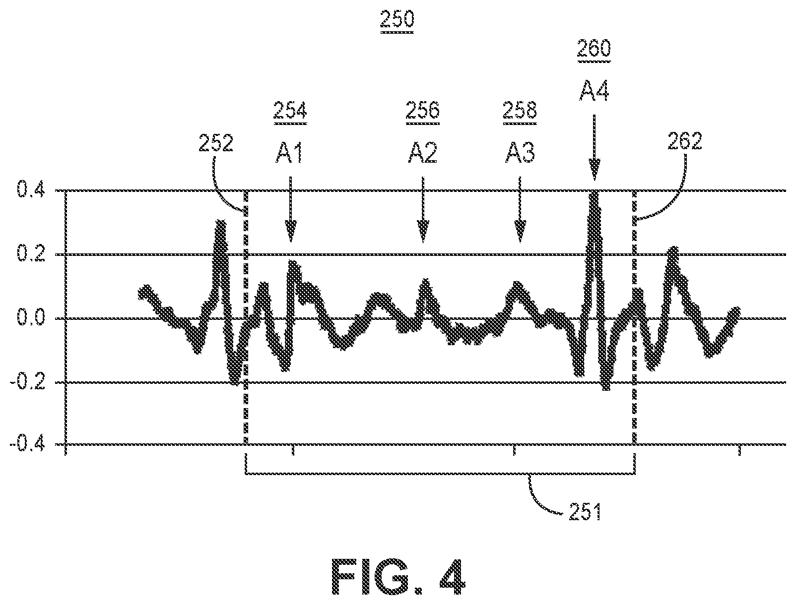 Patent US12472364 Figure 4 – Post-ventricular atrial blanking in a cardiac device