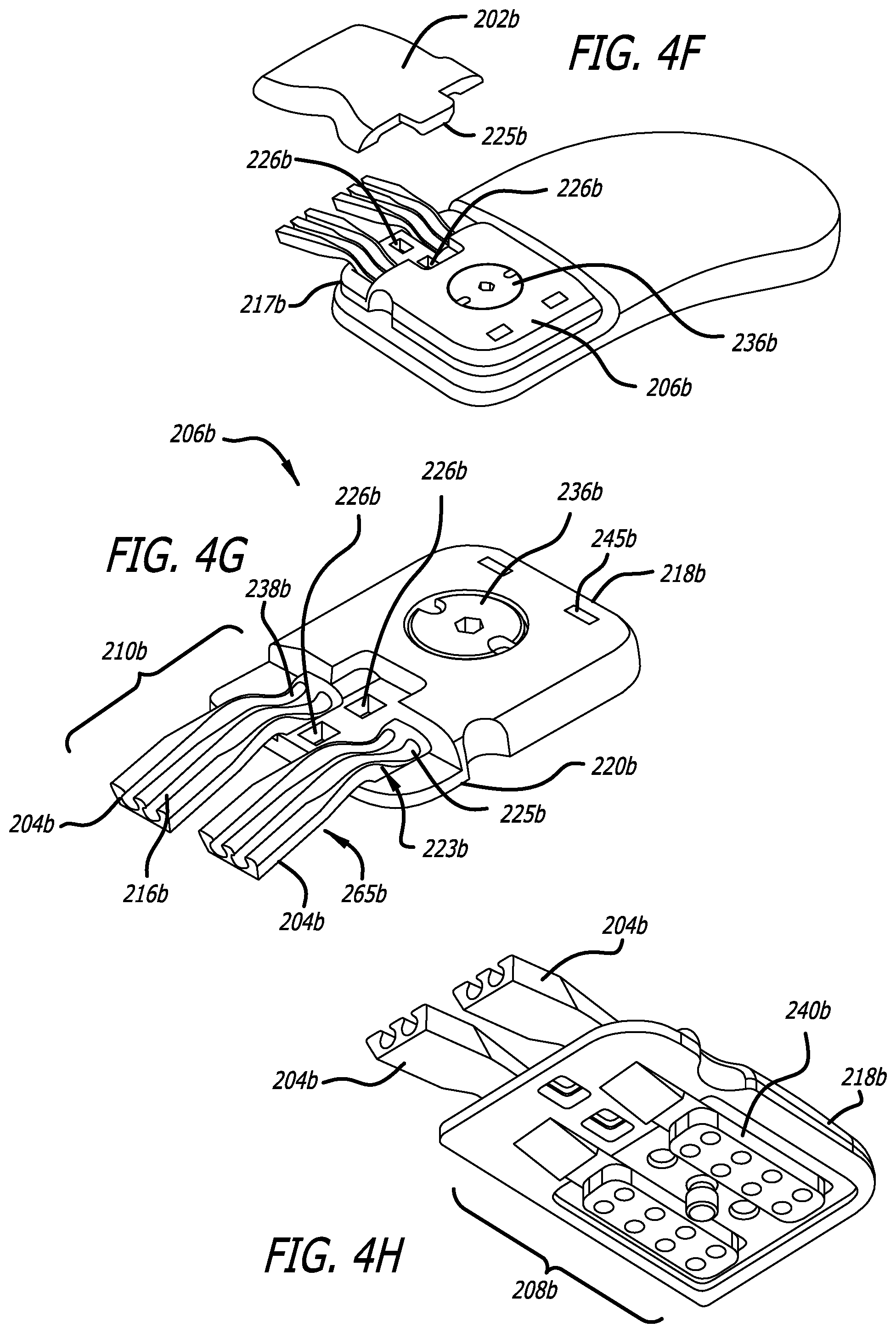 Patent US12472367 Figure 12 – Strain relief systems for active implantable medical devices
