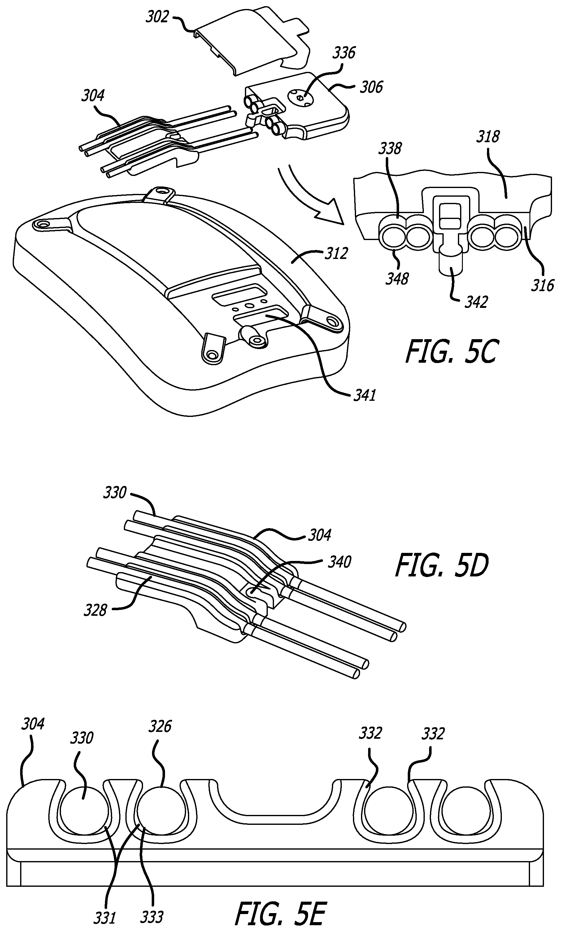 Patent US12472367 Figure 15 – Strain relief systems for active implantable medical devices