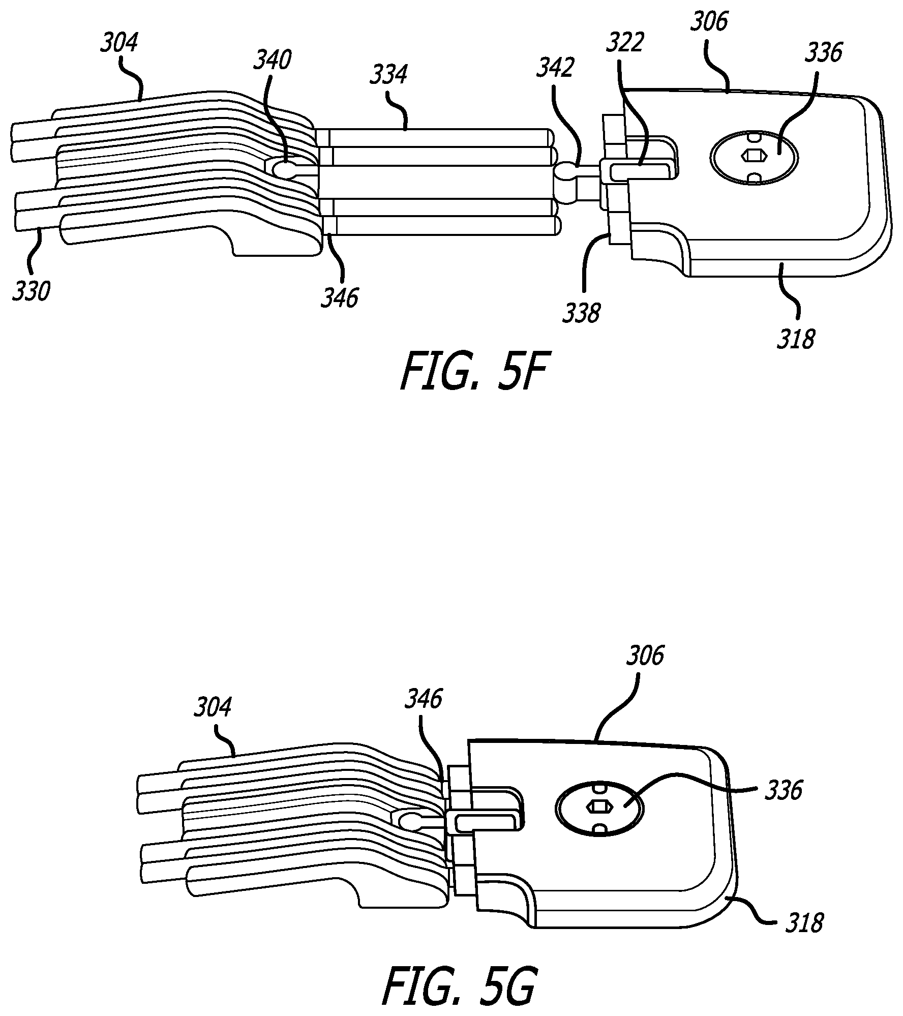 Patent US12472367 Figure 16 – Strain relief systems for active implantable medical devices