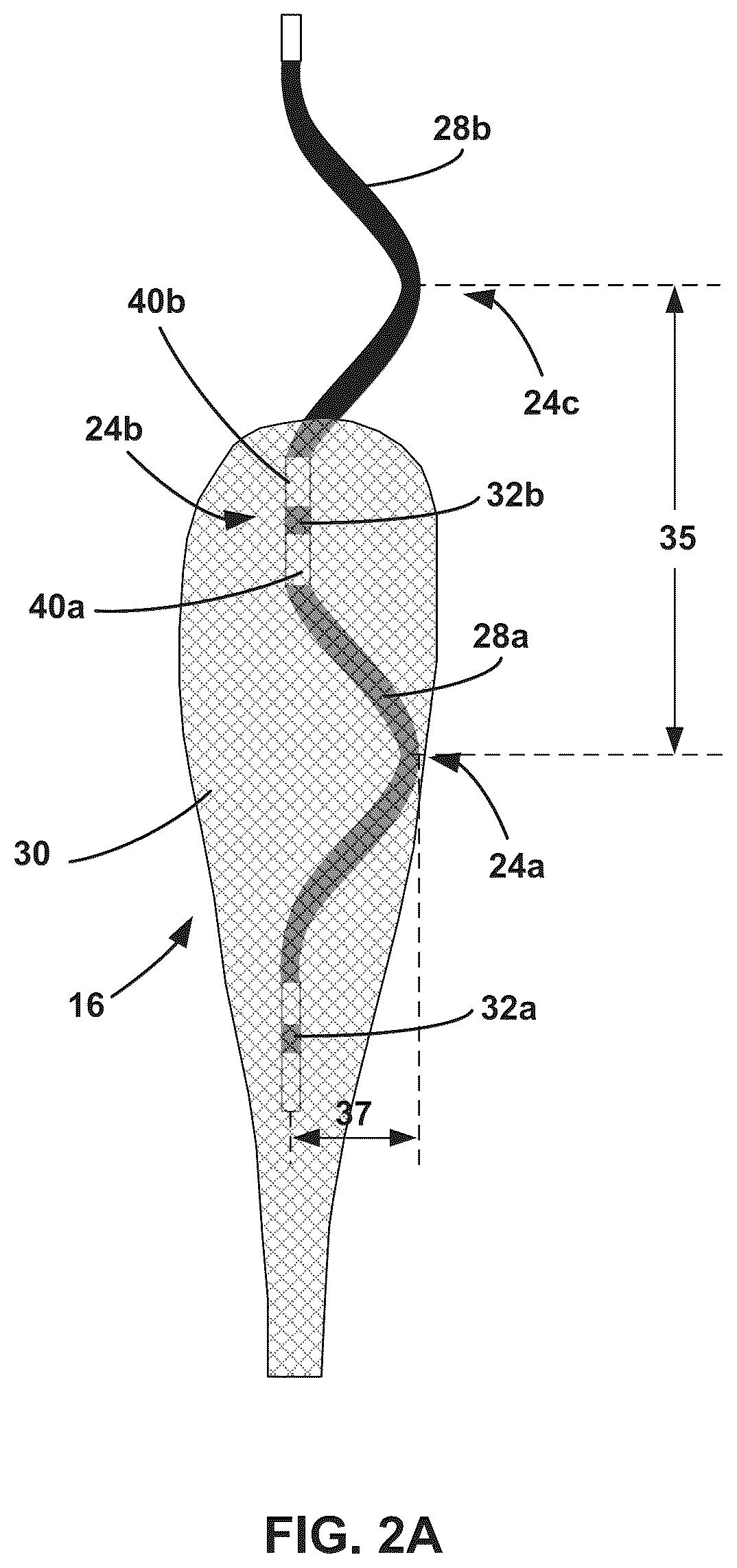 Patent US12472369 Figure 4 – Implantable medical lead shield