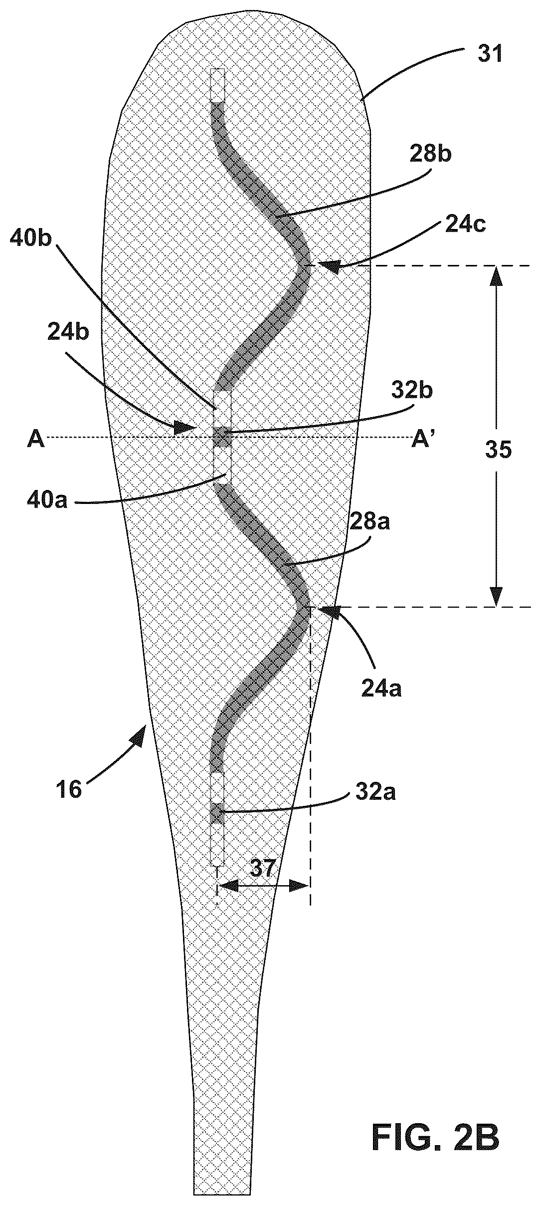 Patent US12472369 Figure 5 – Implantable medical lead shield
