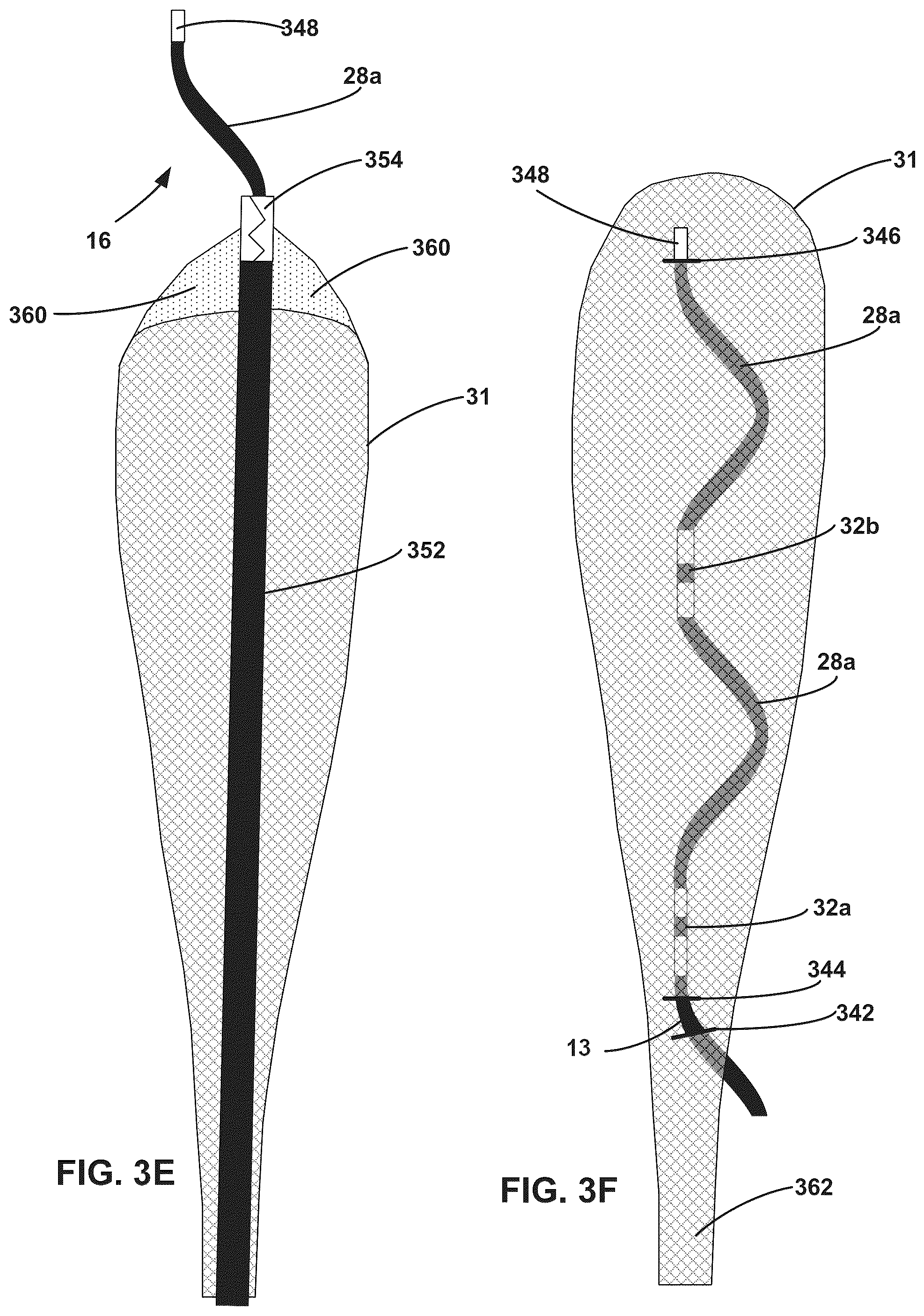 Patent US12472369 Figure 8 – Implantable medical lead shield