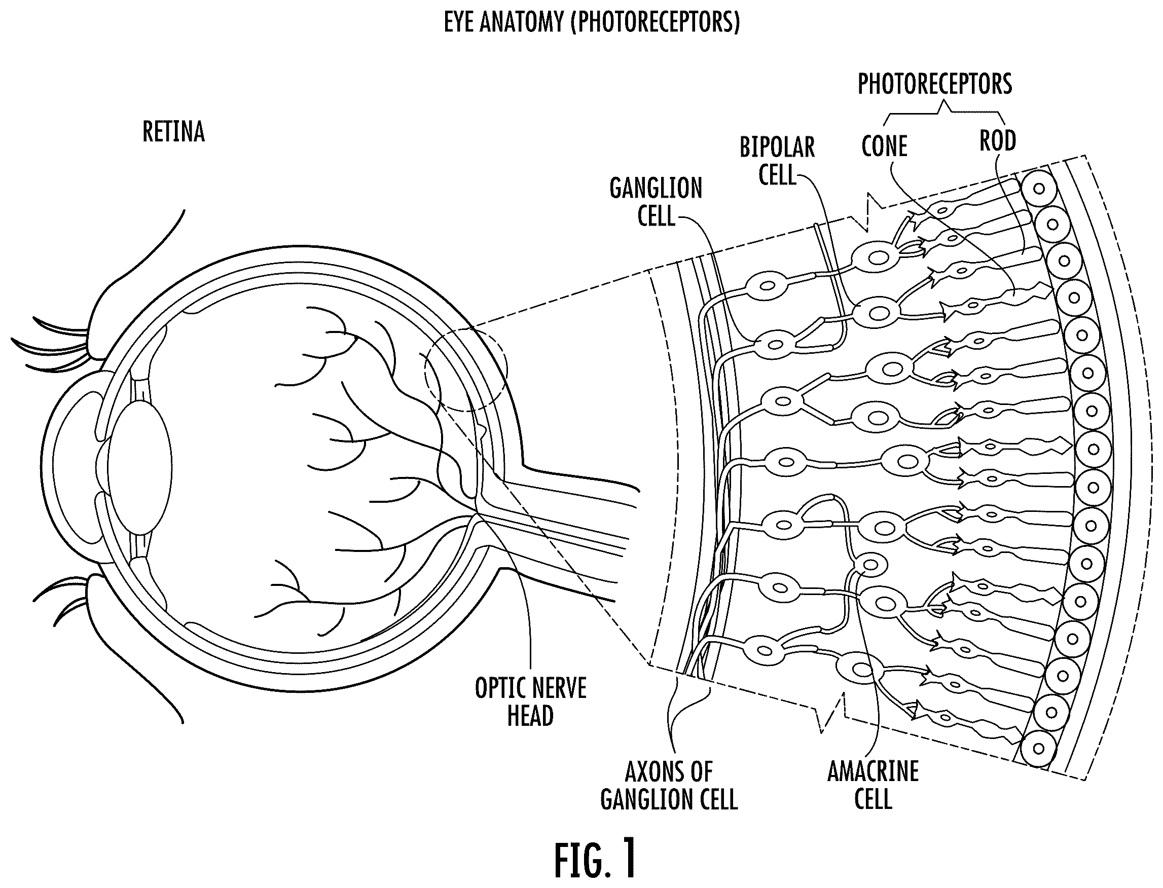 Patent US12472377 Figure 1 – Filtering eyewear and optics for ocular photo-bio-stimulation