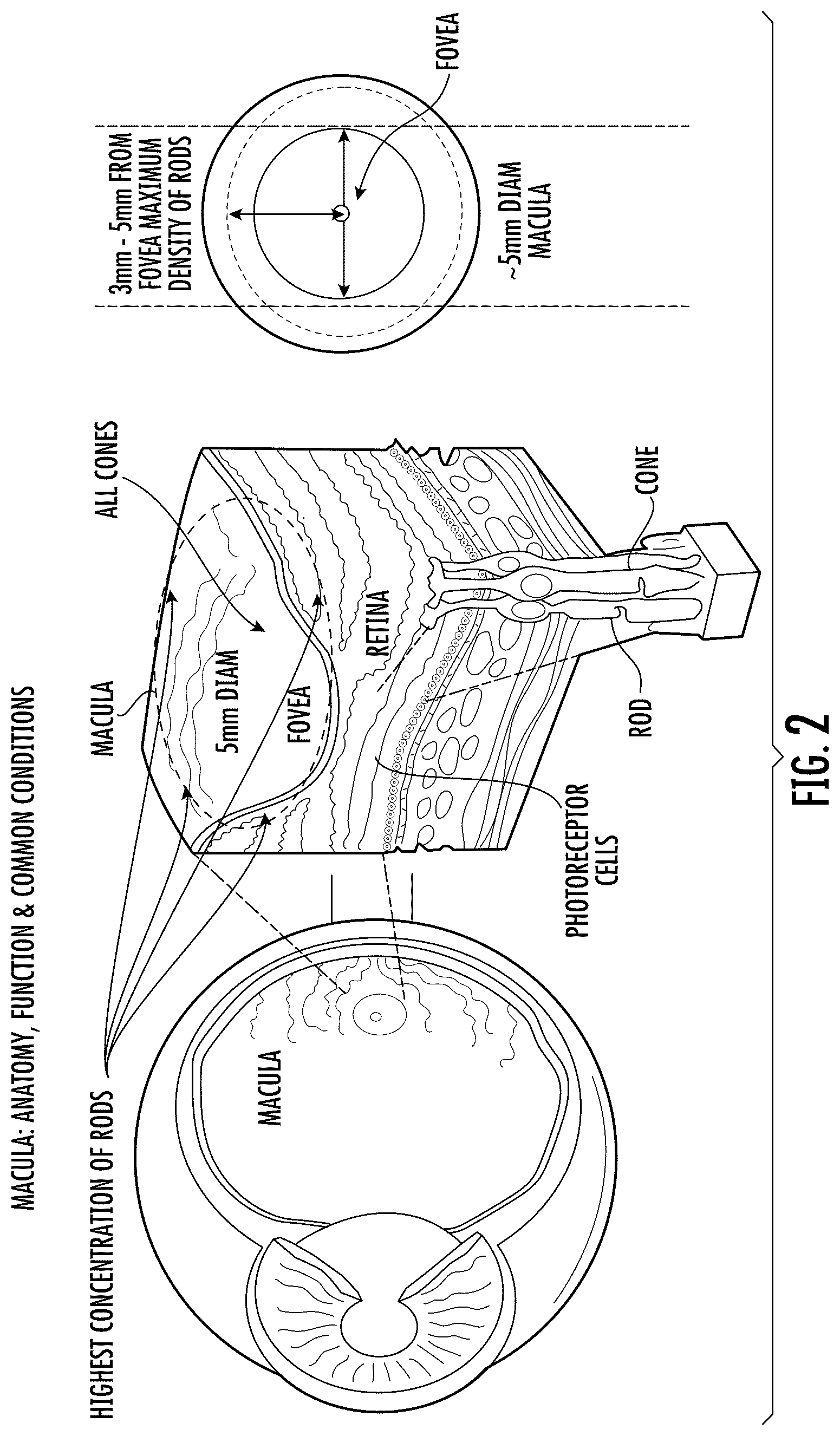 Patent US12472377 Figure 2 – Filtering eyewear and optics for ocular photo-bio-stimulation