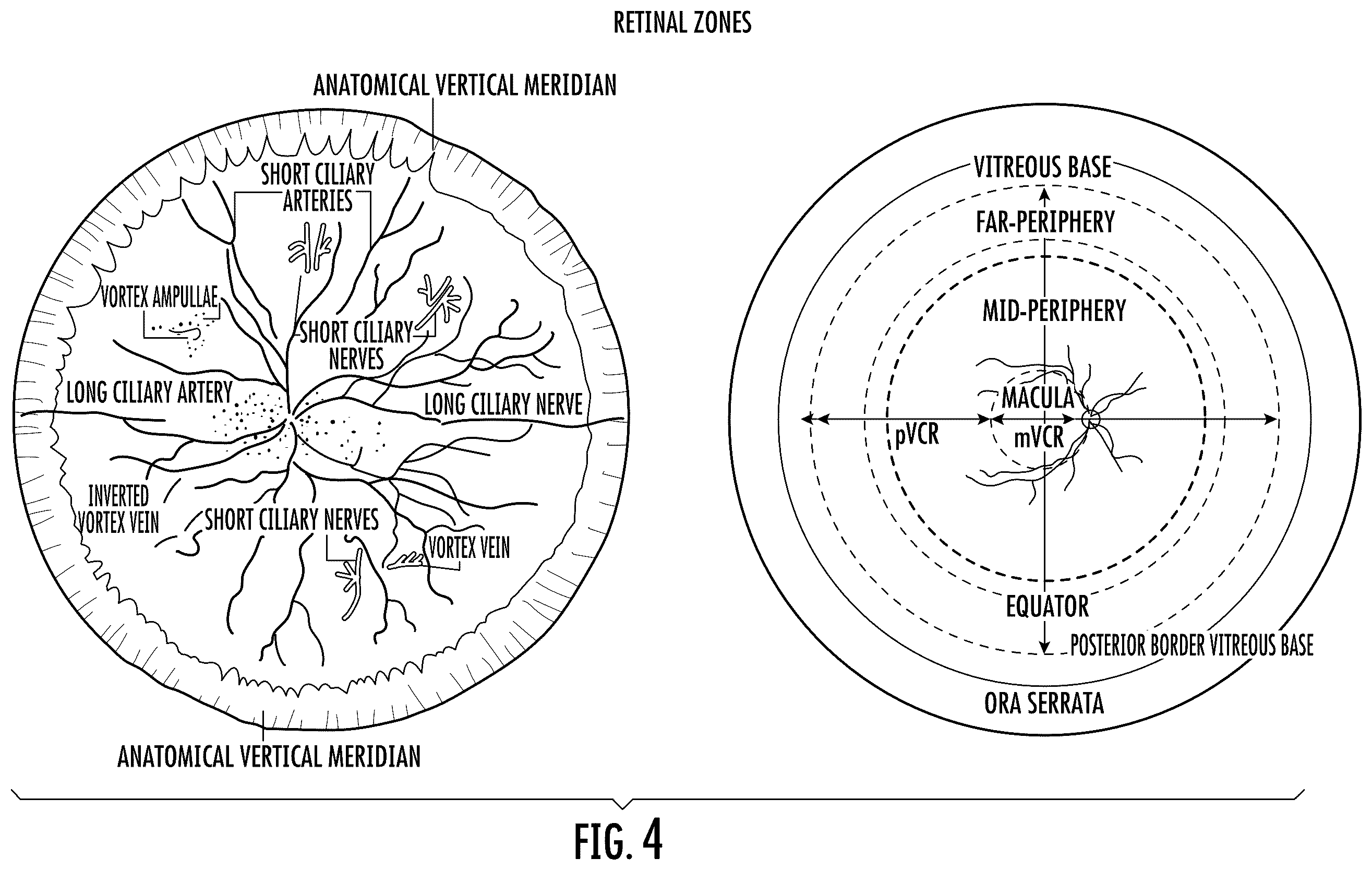 Patent US12472377 Figure 4 – Filtering eyewear and optics for ocular photo-bio-stimulation
