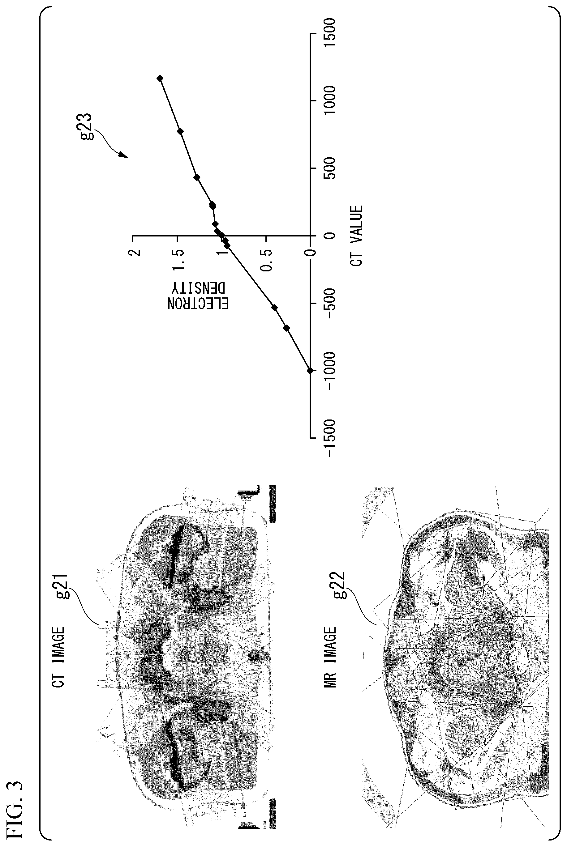 Patent US12472379 Figure 3 – Dose distribution creating program in consideration of influence of magnetic field, dose distribution creating method in consideration of influence of magnetic field, and dose distribution creating apparatus