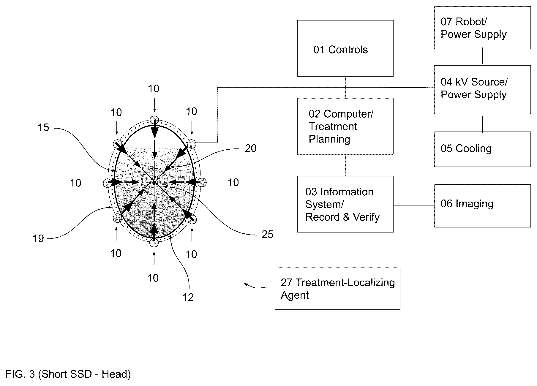 Patent US12472380 Figure 3 – Gradient optimized radial treatment (GORT)