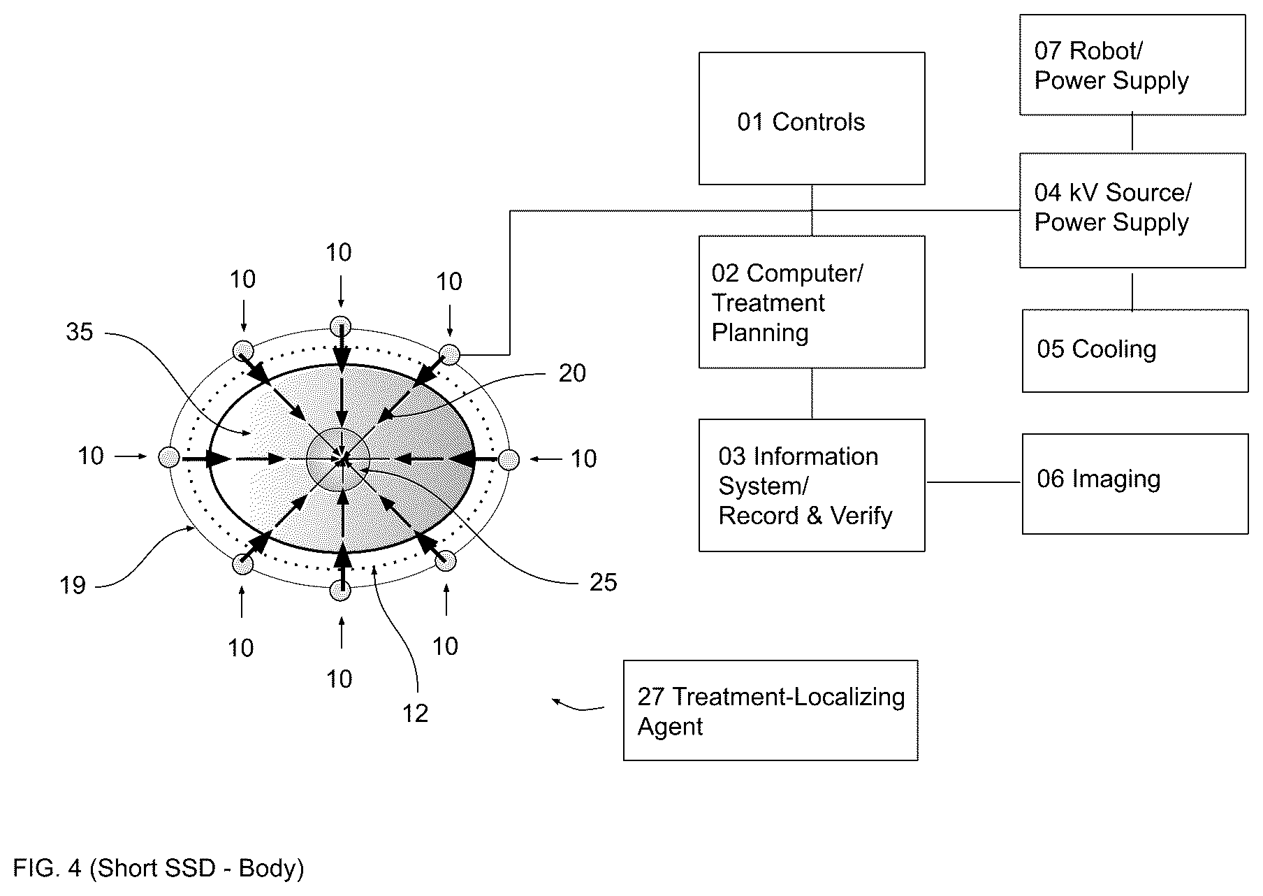 Patent US12472380 Figure 4 – Gradient optimized radial treatment (GORT)
