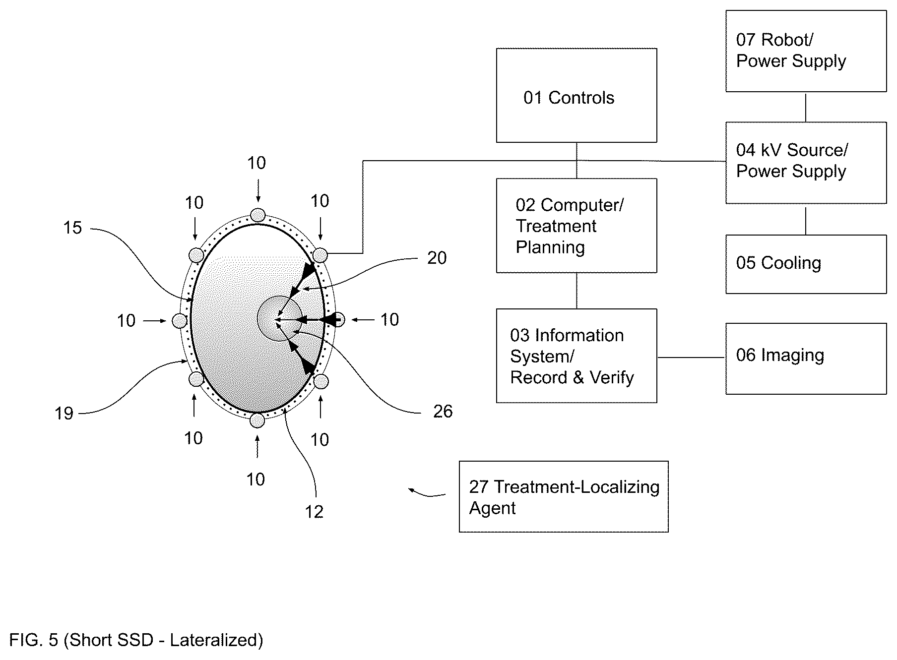 Patent US12472380 Figure 5 – Gradient optimized radial treatment (GORT)