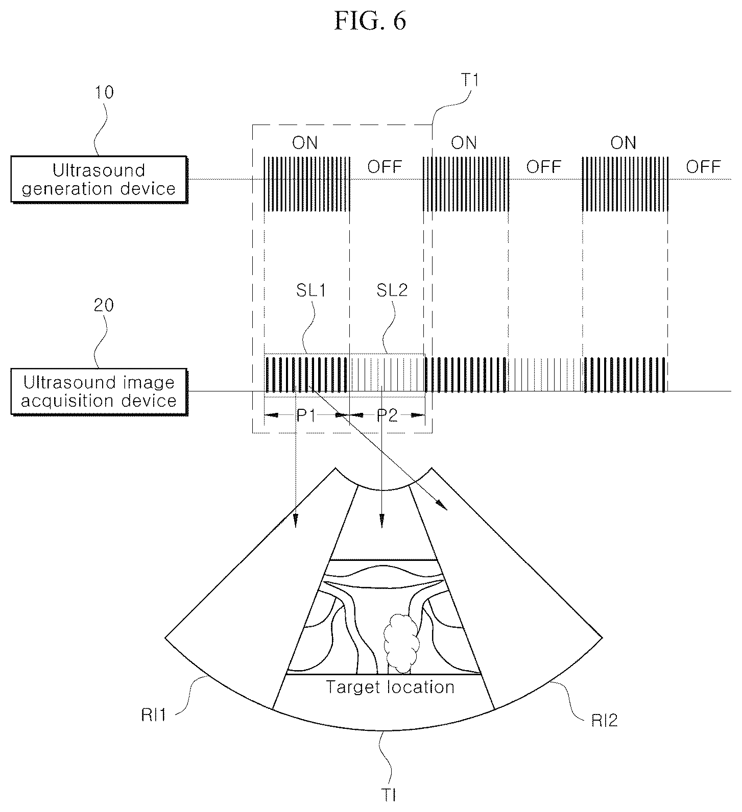 Patent US12472386 Figure 5 – Ultrasound image processing apparatus, method, program and system