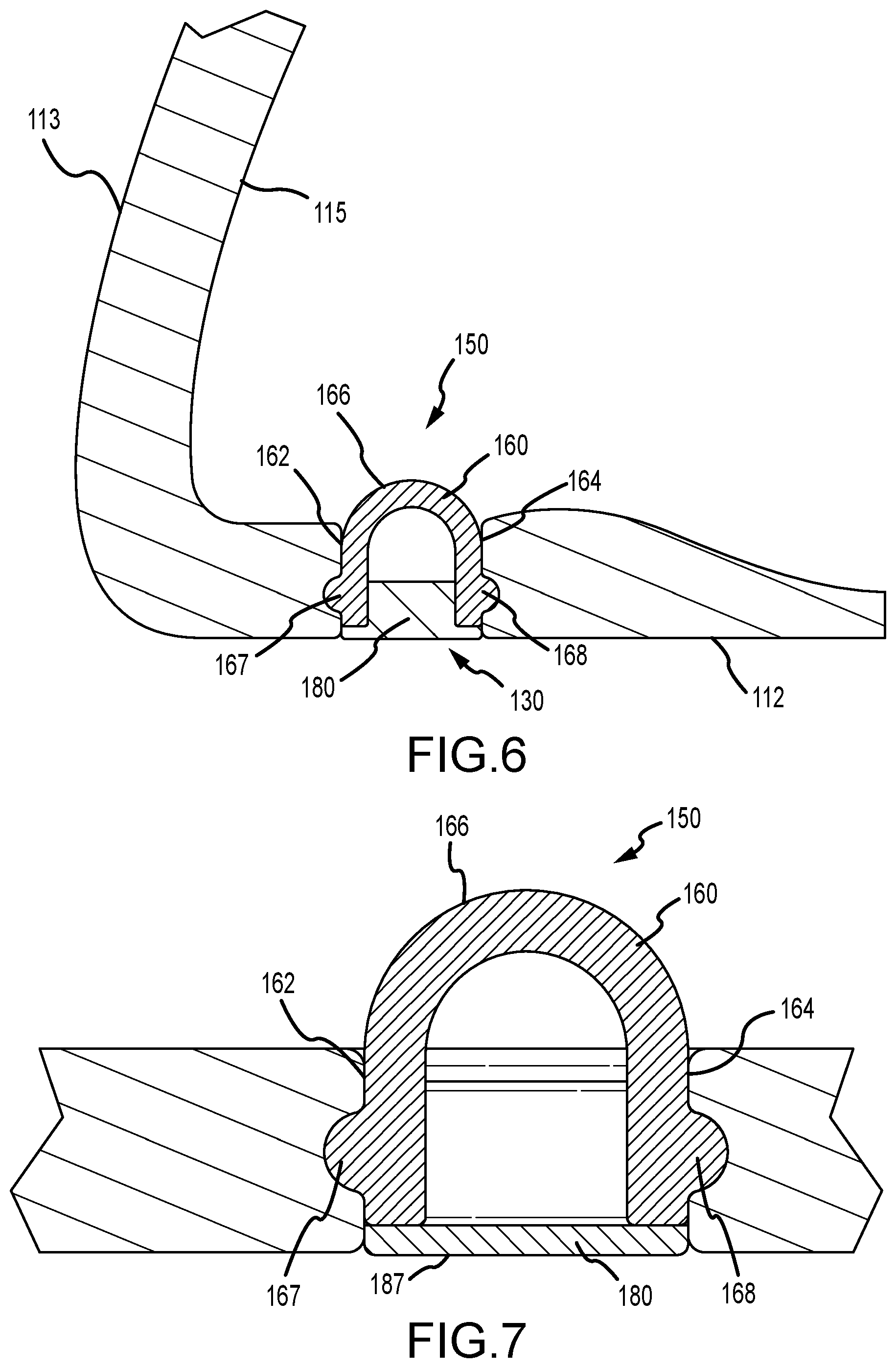 Patent US12472407 Figure 5 – Golf club heads with slits and flexure inserts