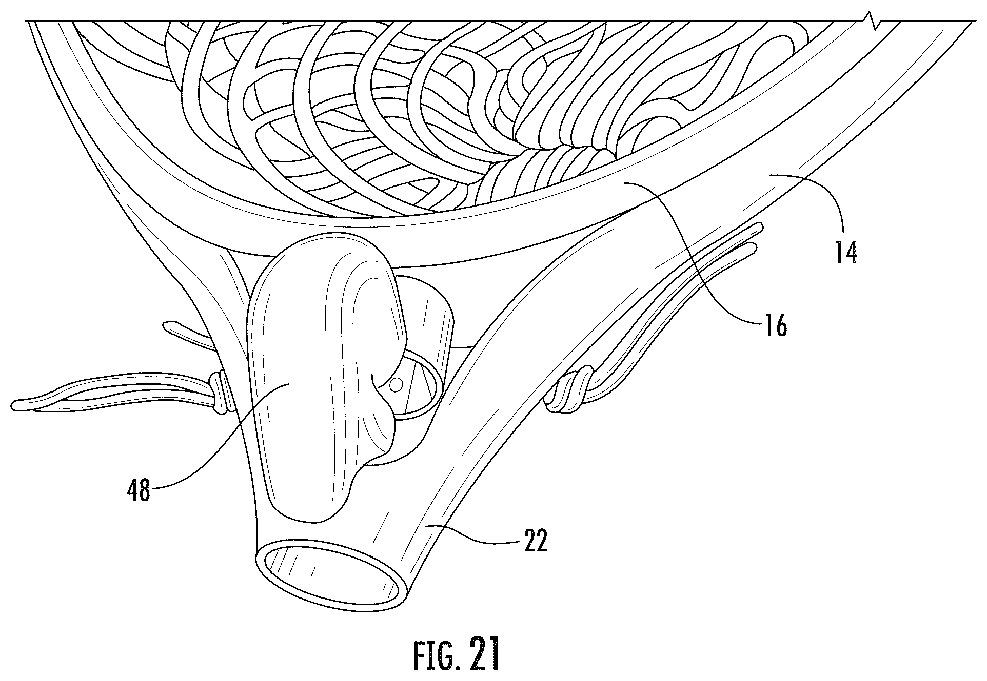 Patent US12472411 Figure 6 – Anti-rotation element for a lacrosse goalie stick