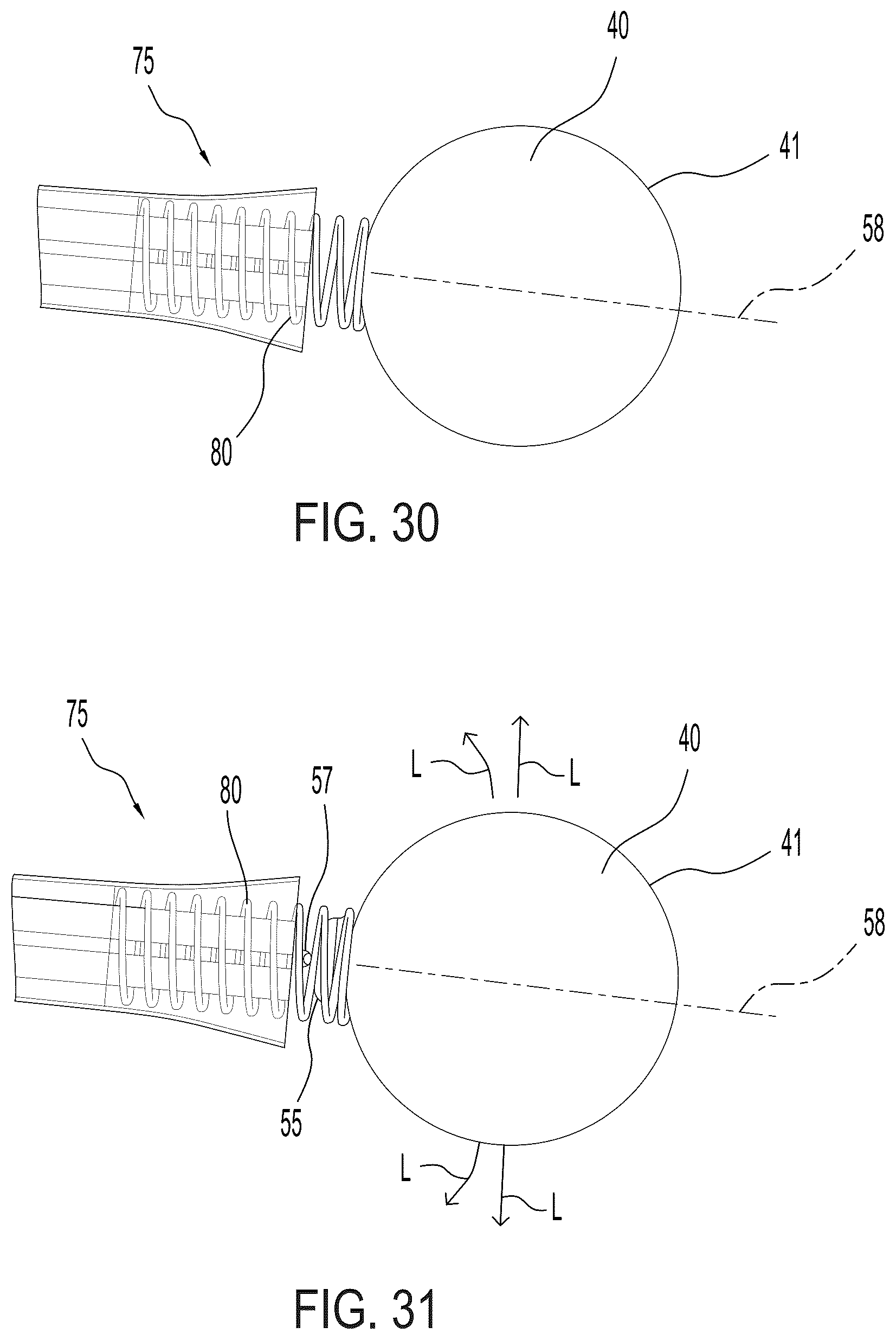 Patent US12472412 Figure 17 – Return apparatuses